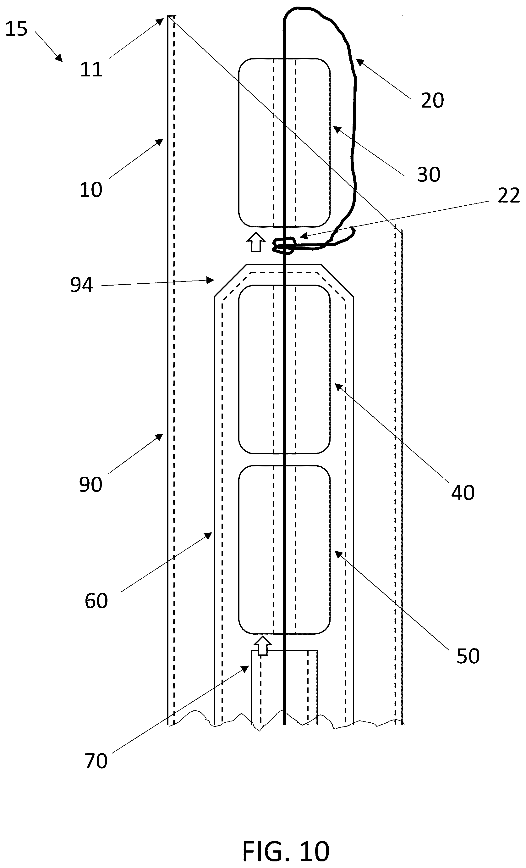 Patent US12396719 Figure 18 – Soft tissue fixation system