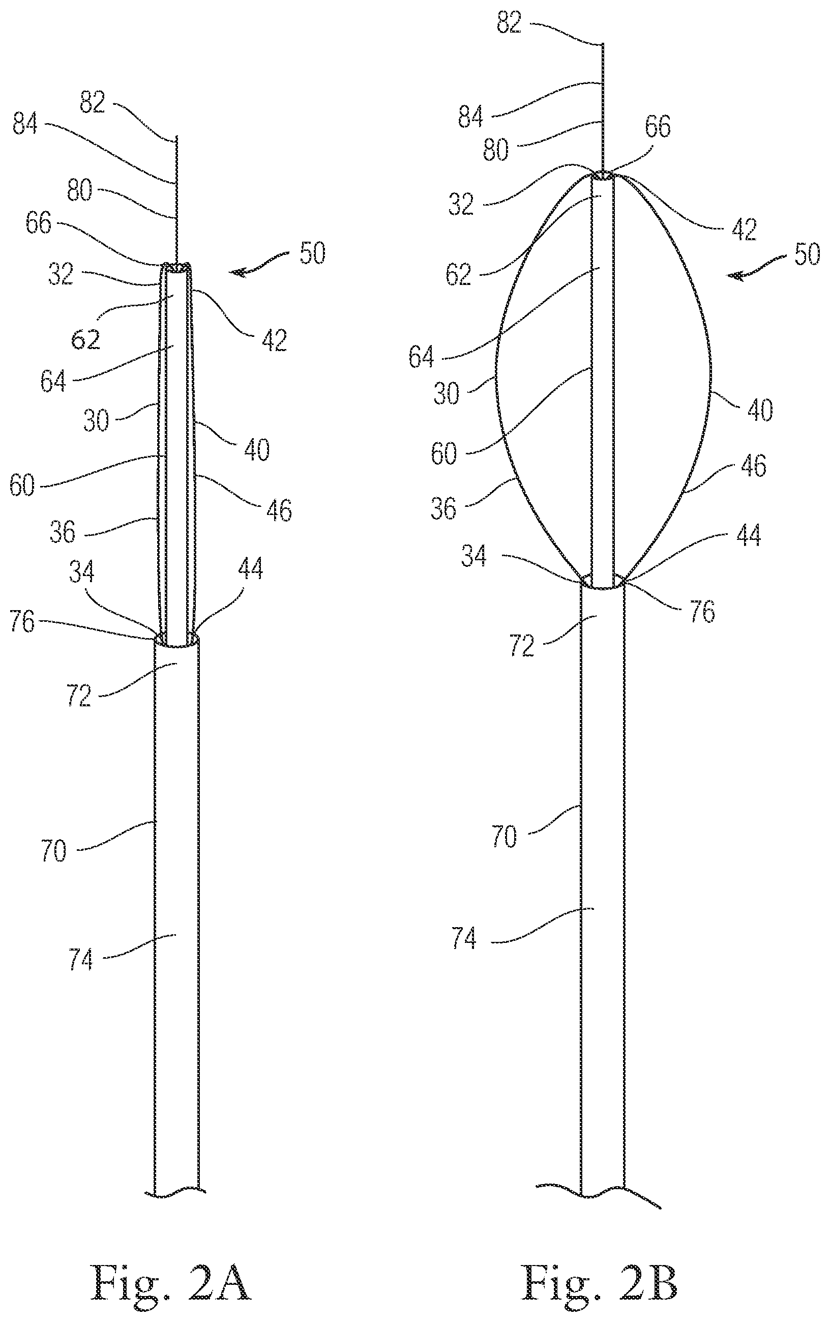 Patent US12396720 Figure 2 – Devices and methods for locating and implanting tissue anchors at mitral valve commissure