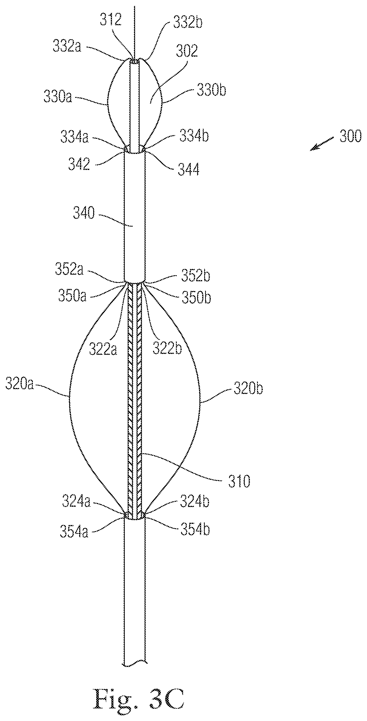 Patent US12396720 Figure 4 – Devices and methods for locating and implanting tissue anchors at mitral valve commissure