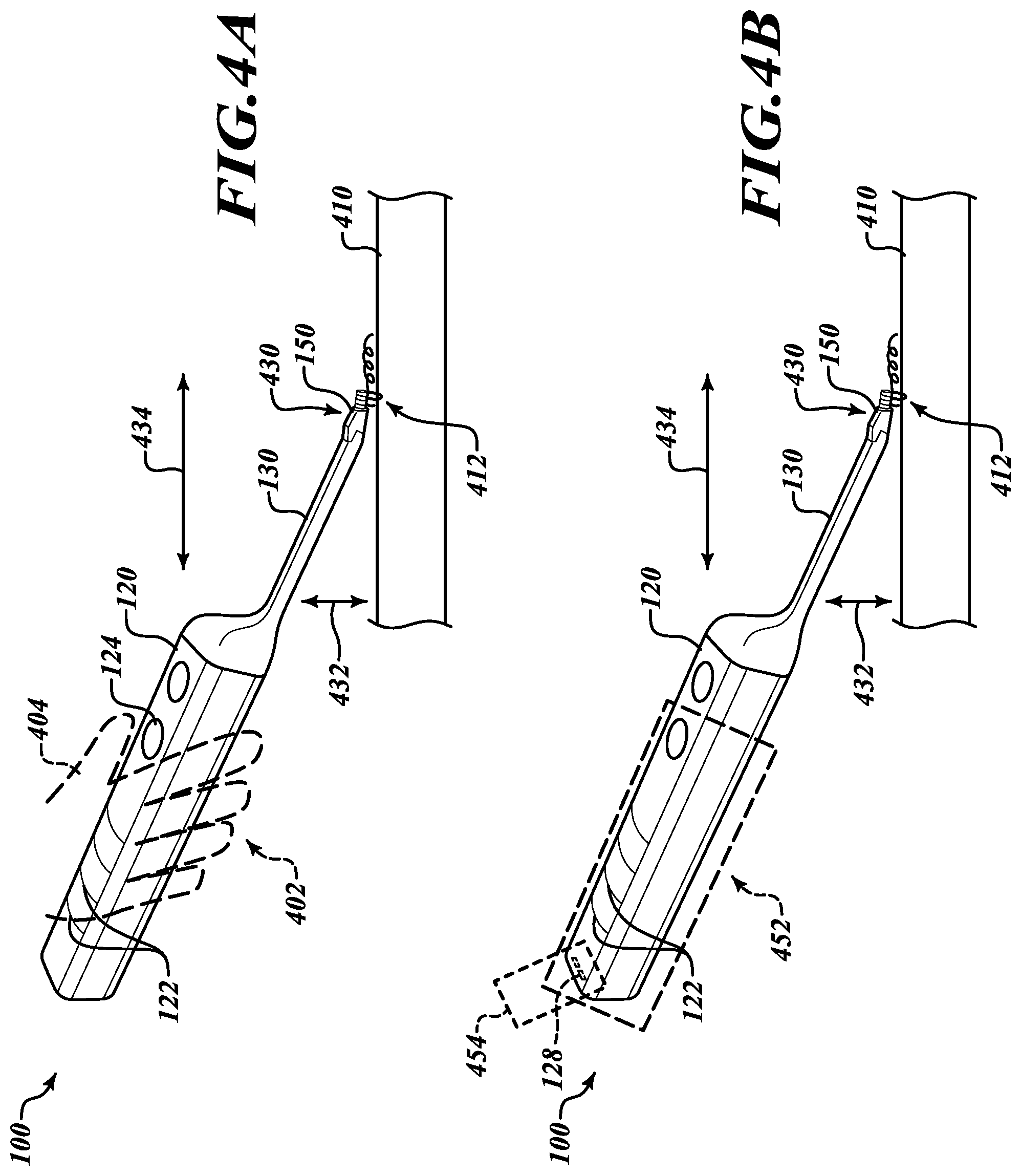 Patent US12396722 Figure 4 – Movable suturing apparatus and method