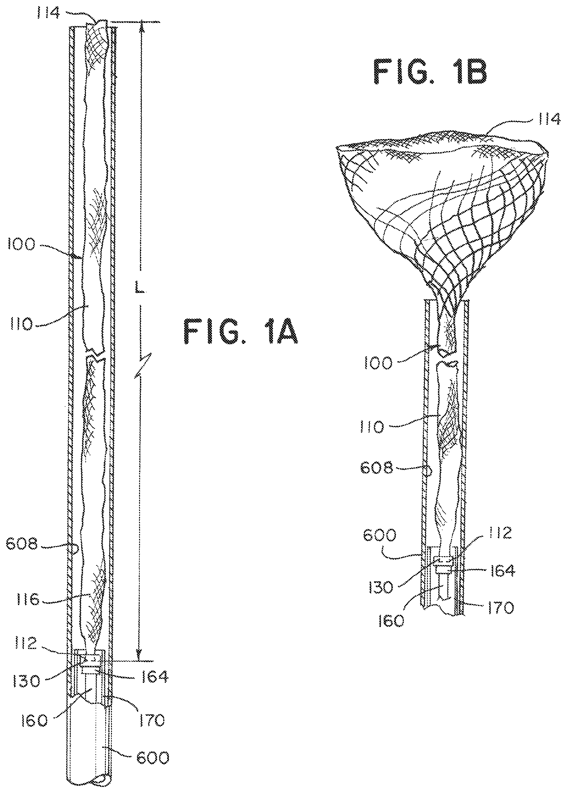 Patent US12396730 Figure 1 – Braided implant with detachment mechanism