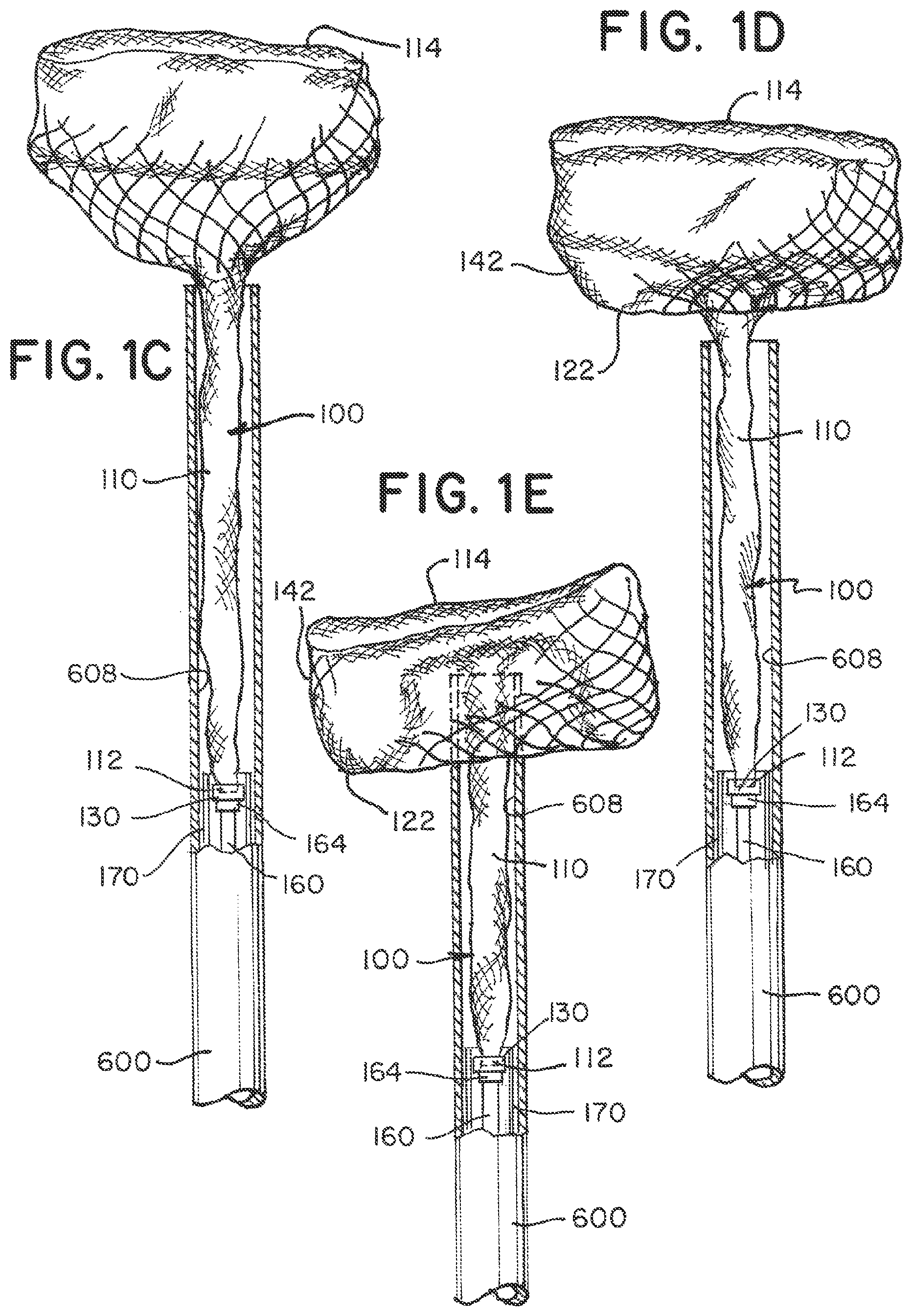 Patent US12396730 Figure 2 – Braided implant with detachment mechanism