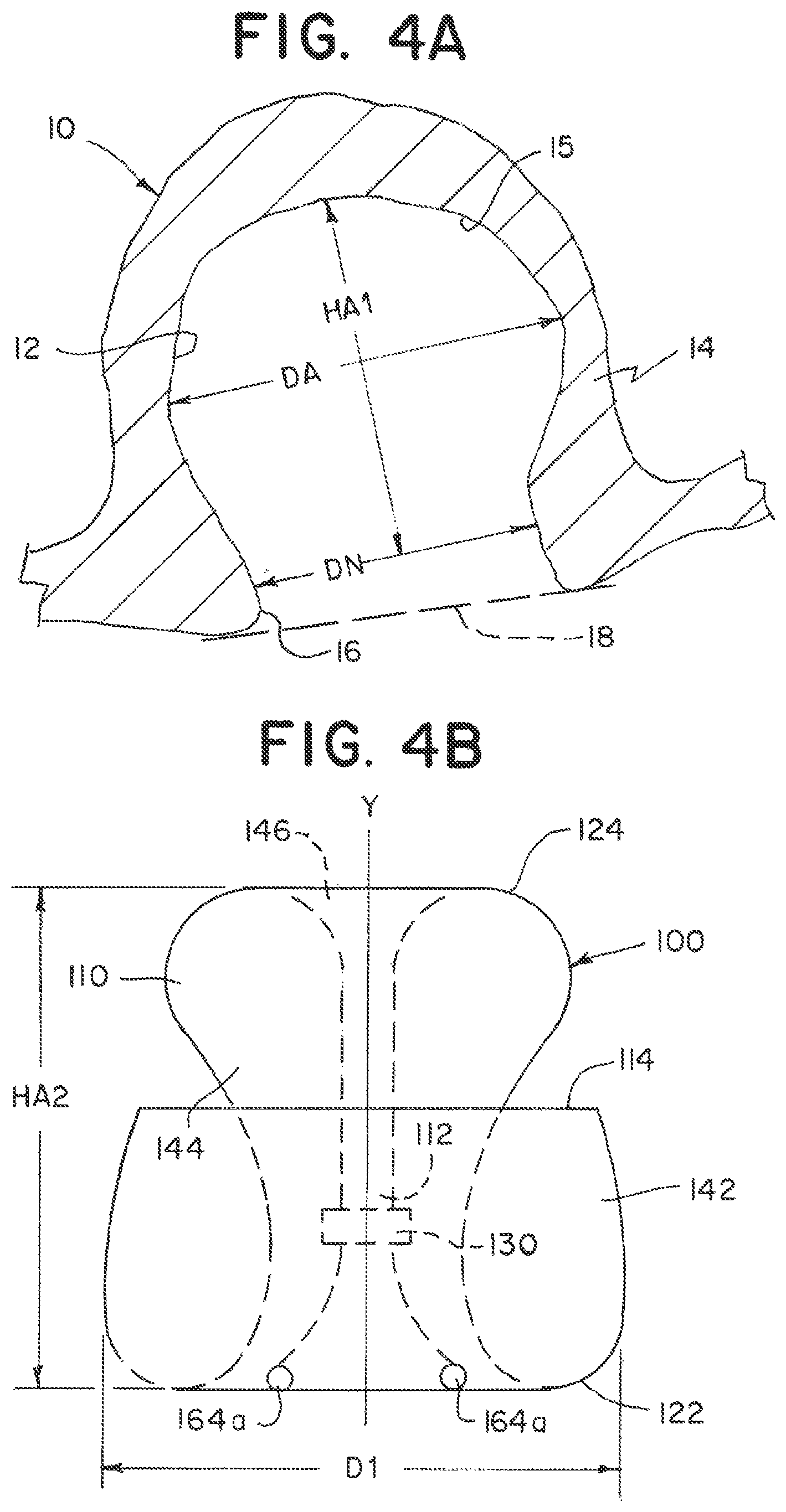 Patent US12396730 Figure 5 – Braided implant with detachment mechanism
