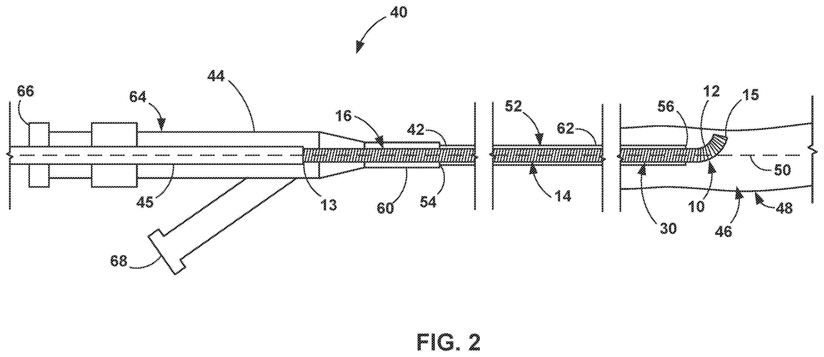Patent US12396731 Figure 2 – Implantable embolization device