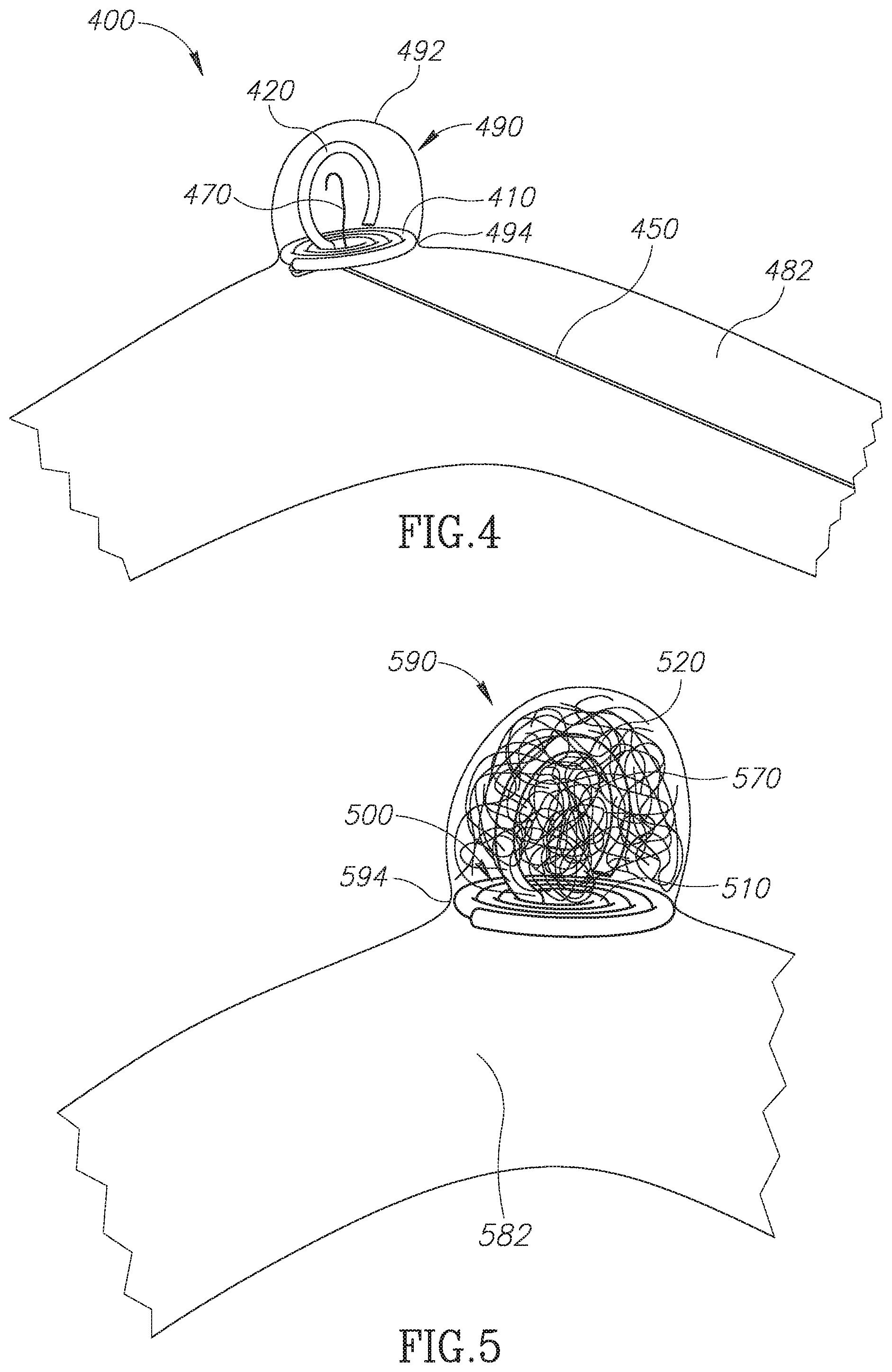Patent US12396733 Figure 3 – Device for restricting blood flow to aneurysms