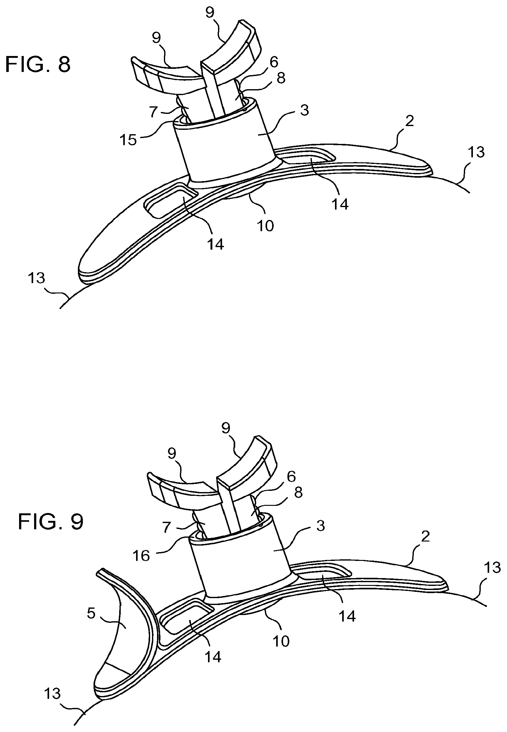 Patent US12396736 Figure 3 – Adhesive pad and hemostasis system