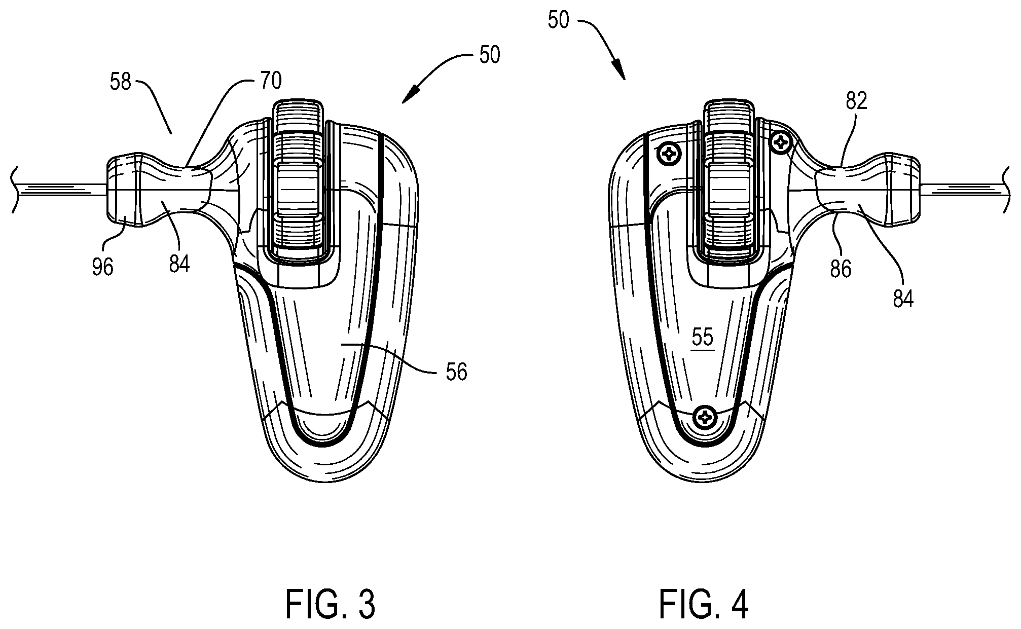 Patent US12396738 Figure 3 – Device including steering cables for creating a cavity or a channel in bone