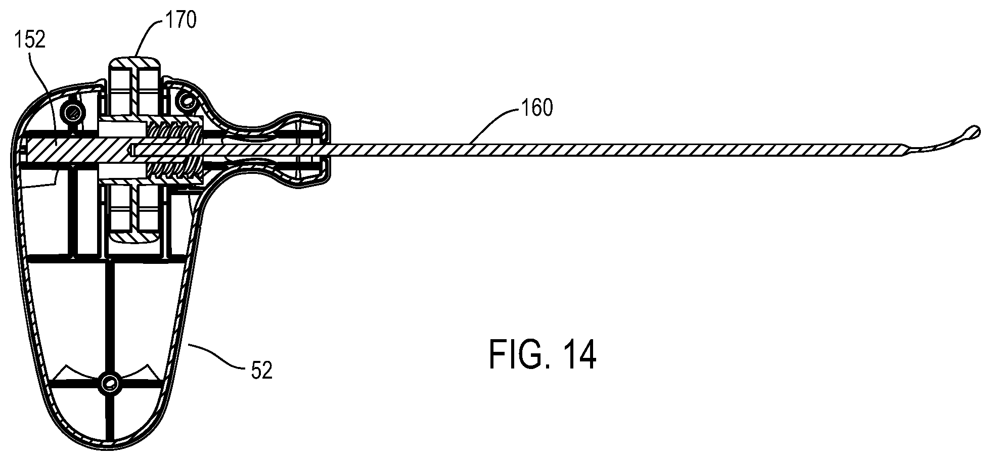 Patent US12396738 Figure 9 – Device including steering cables for creating a cavity or a channel in bone
