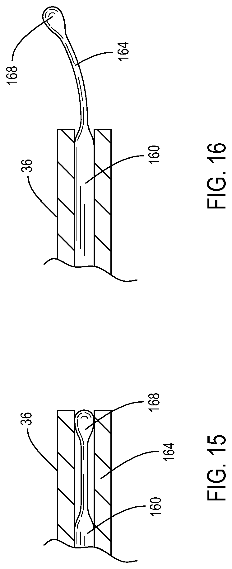 Patent US12396738 Figure 10 – Device including steering cables for creating a cavity or a channel in bone
