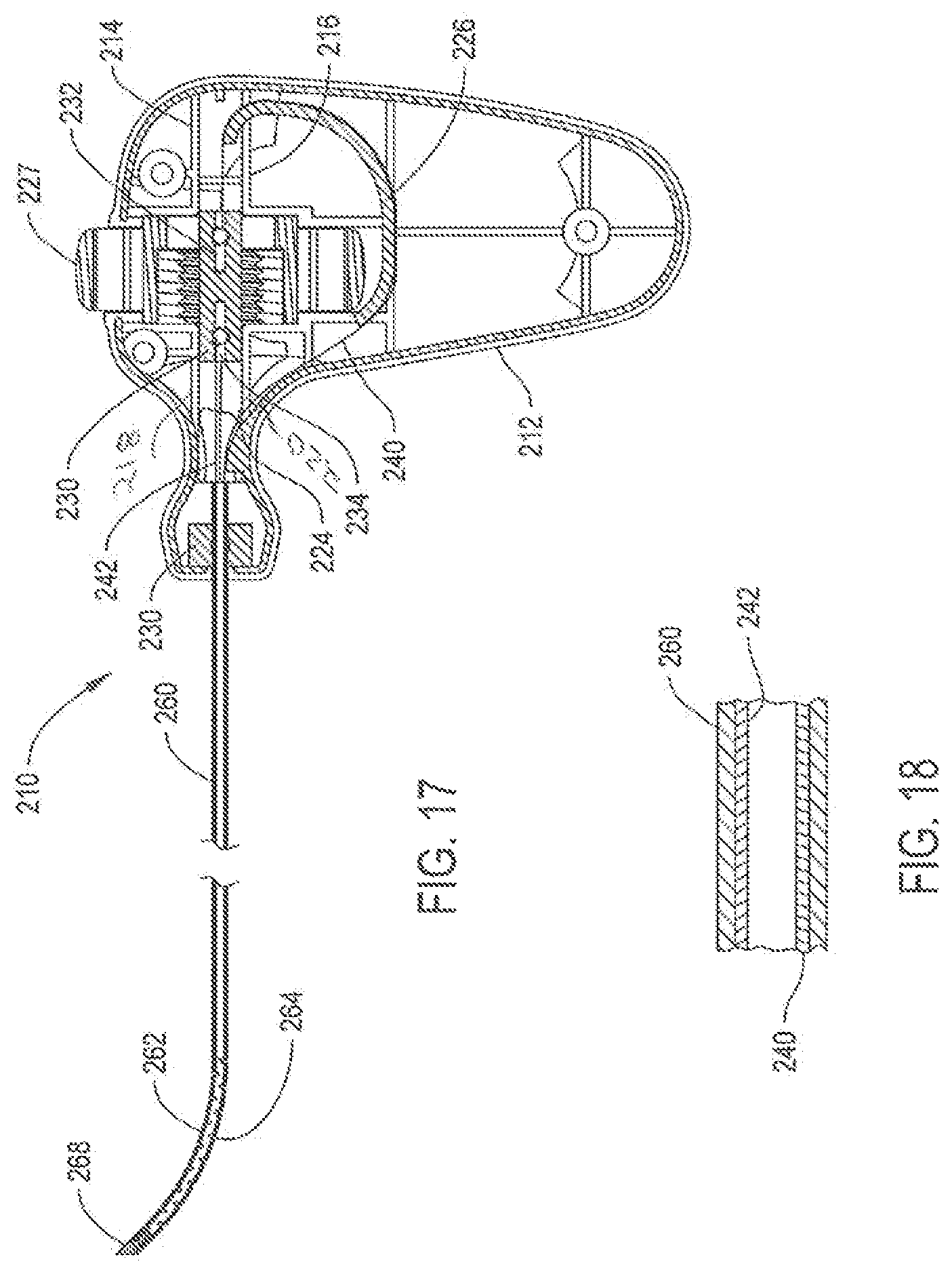 Patent US12396738 Figure 11 – Device including steering cables for creating a cavity or a channel in bone