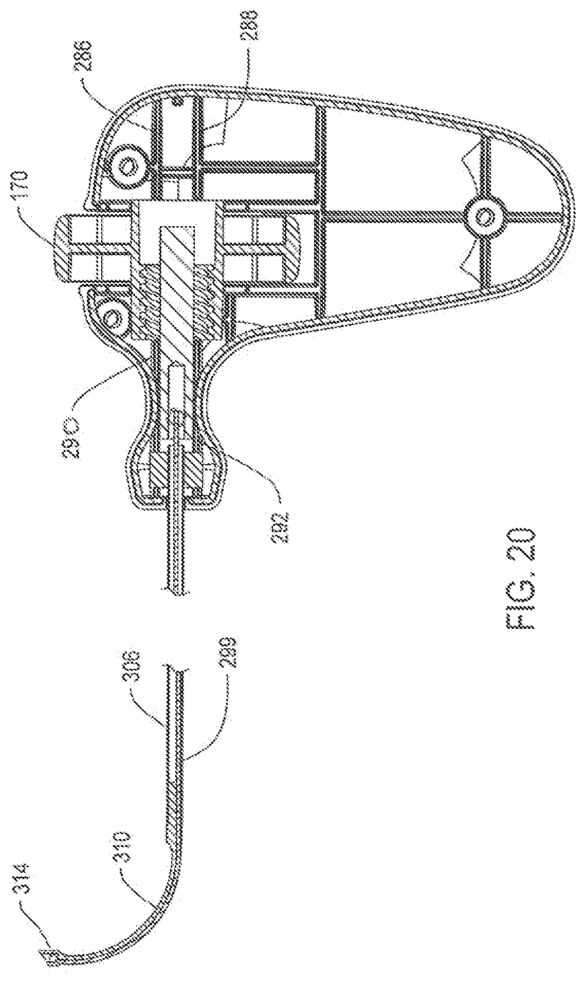 Patent US12396738 Figure 13 – Device including steering cables for creating a cavity or a channel in bone