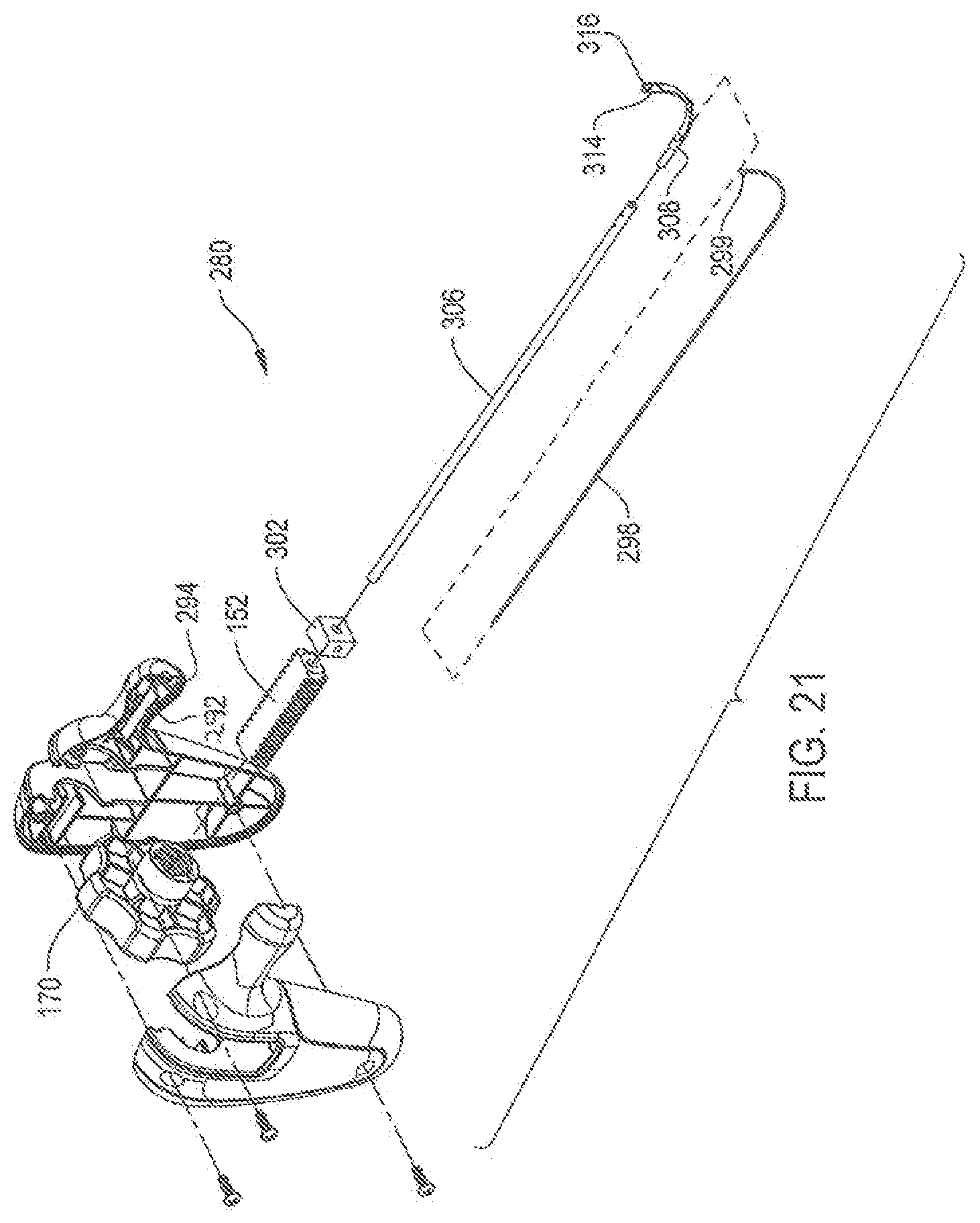 Patent US12396738 Figure 14 – Device including steering cables for creating a cavity or a channel in bone