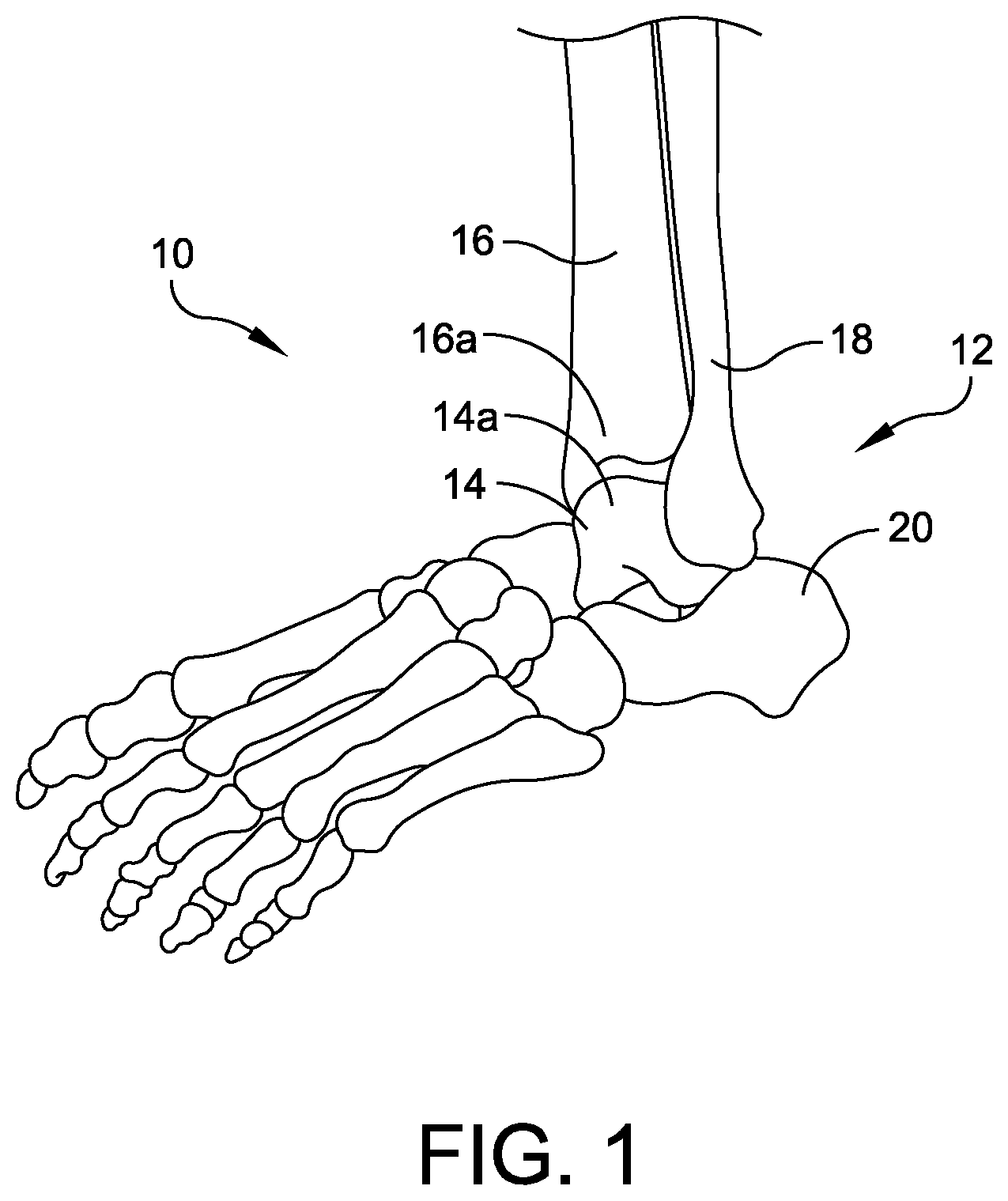 Patent US12396739 Figure 1 – Guidance tools, systems, and methods