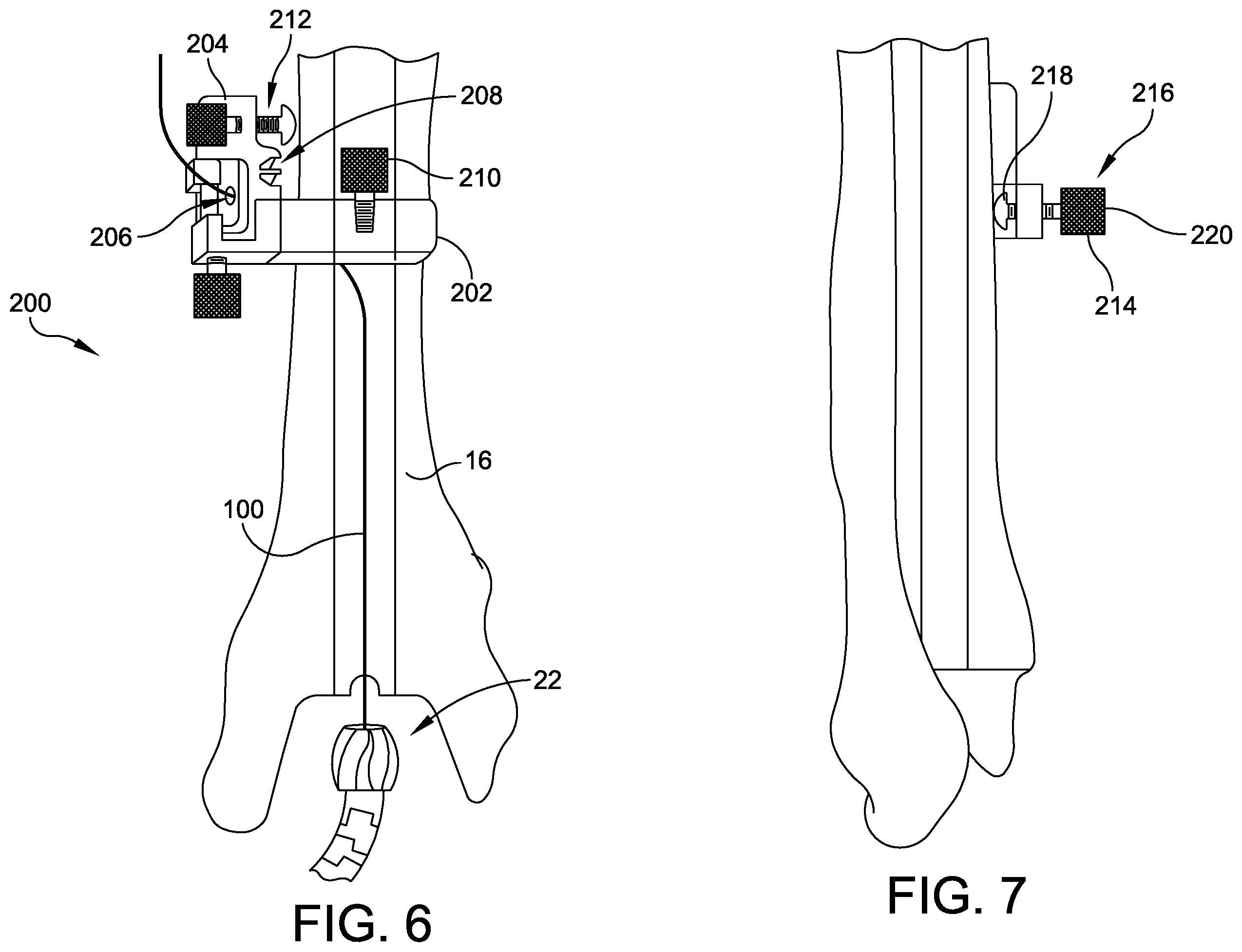 Patent US12396739 Figure 4 – Guidance tools, systems, and methods