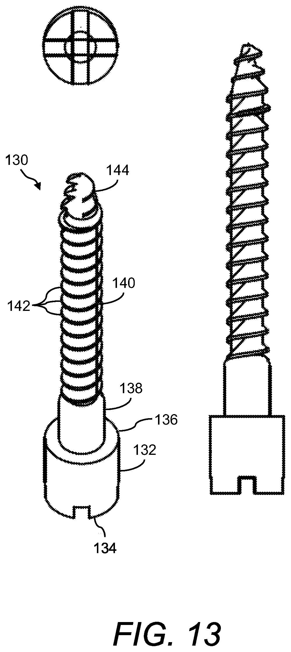 Patent US12396740 Figure 13 – Navigation-guided surgery fixation (NGSF) kit or system and method of using same