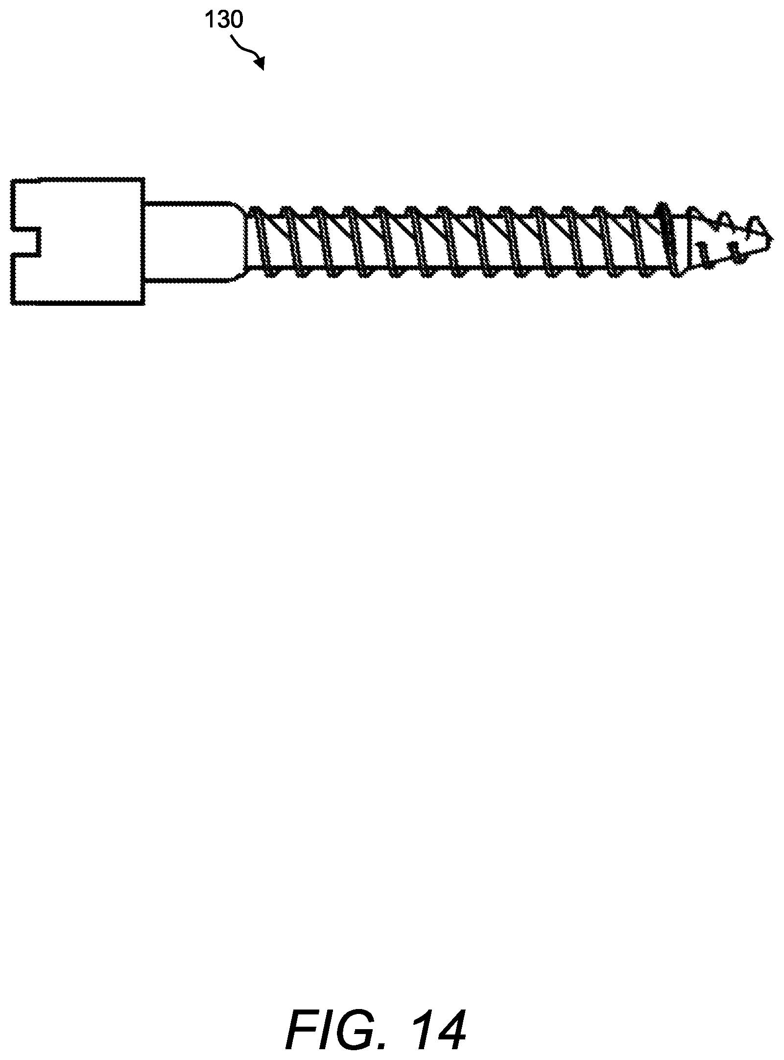 Patent US12396740 Figure 14 – Navigation-guided surgery fixation (NGSF) kit or system and method of using same