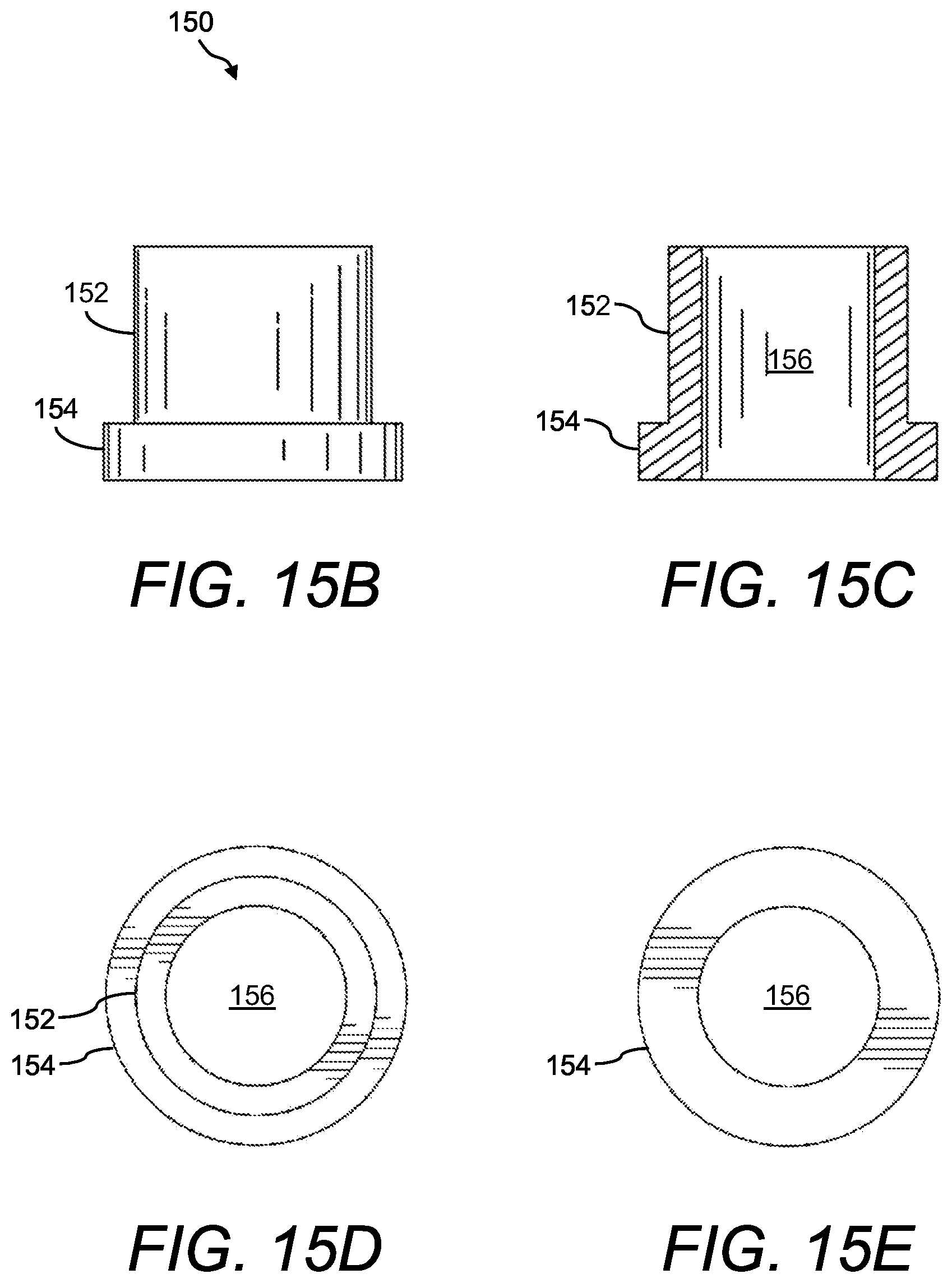 Patent US12396740 Figure 16 – Navigation-guided surgery fixation (NGSF) kit or system and method of using same