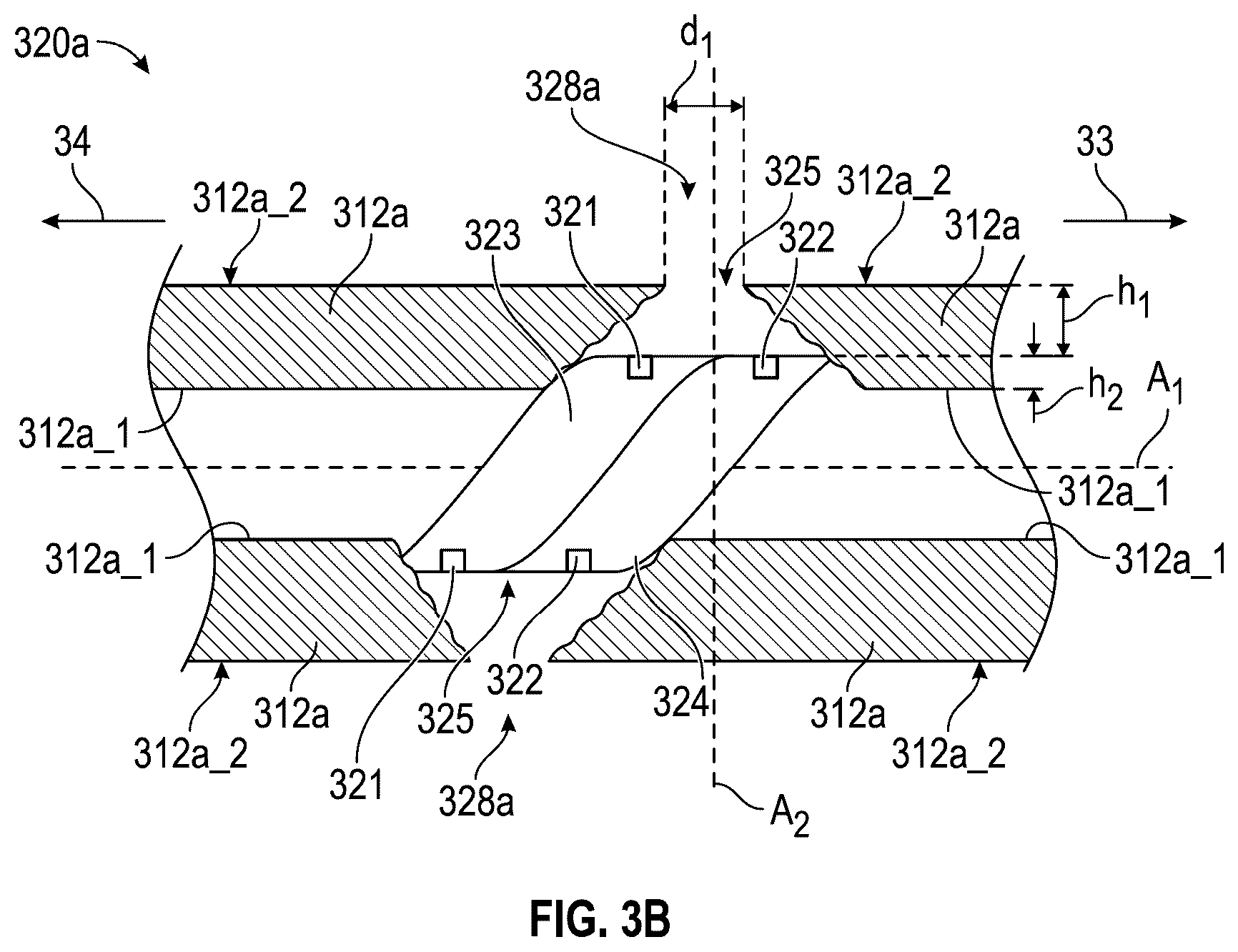 Patent US12396742 Figure 6 – Intravascular lithotripsy system