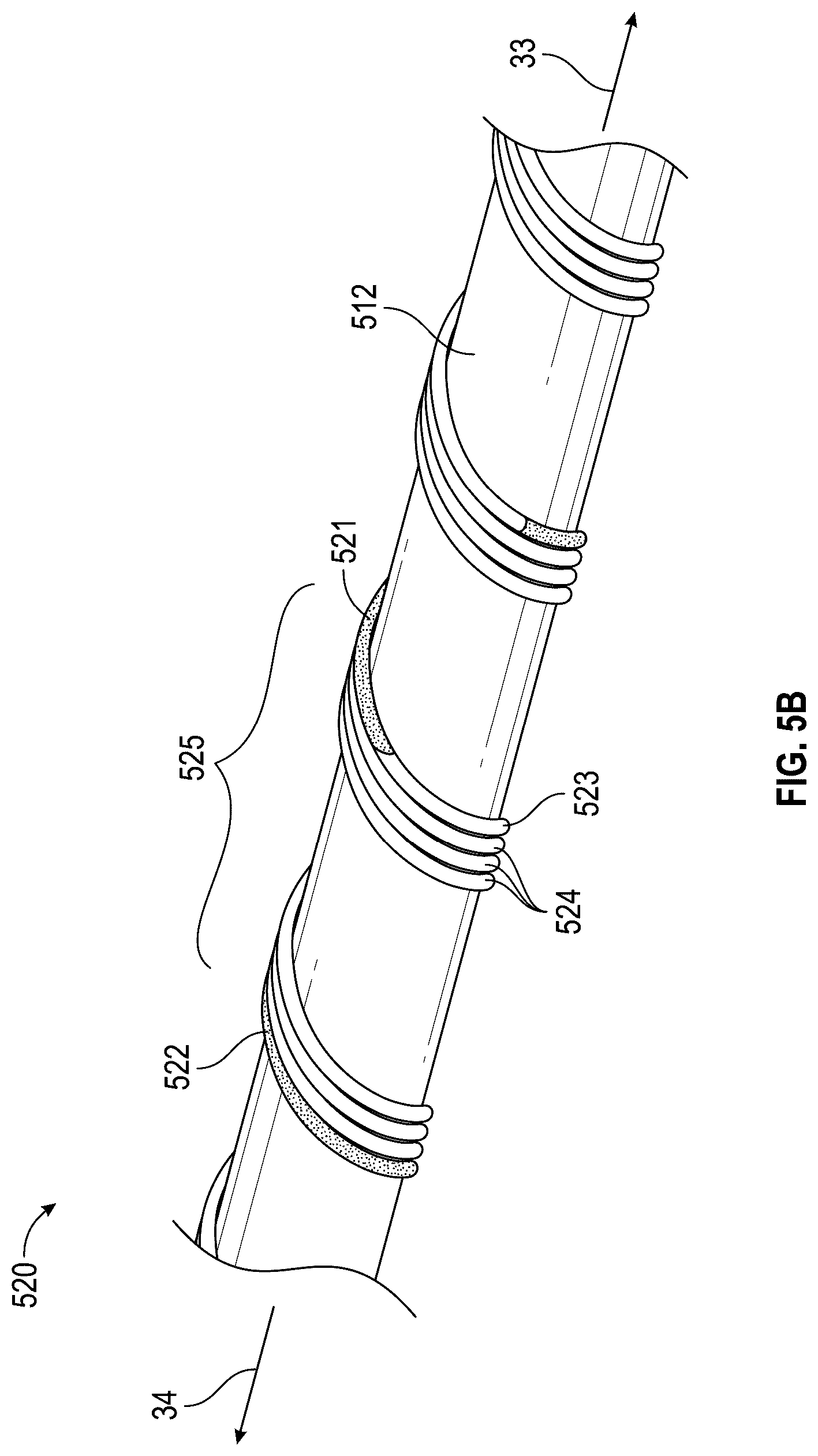 Patent US12396742 Figure 16 – Intravascular lithotripsy system
