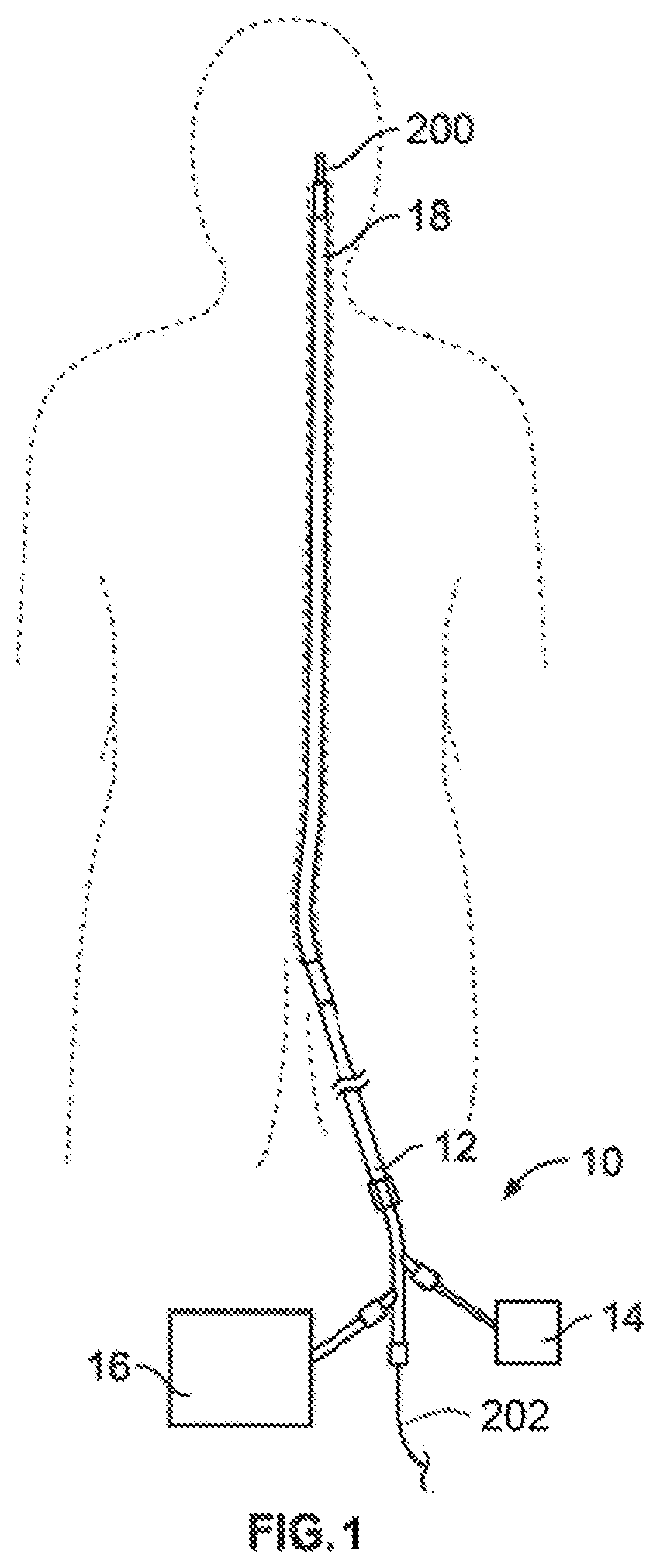 Patent US12396743 Figure 1 – Retrieval systems and methods for use thereof