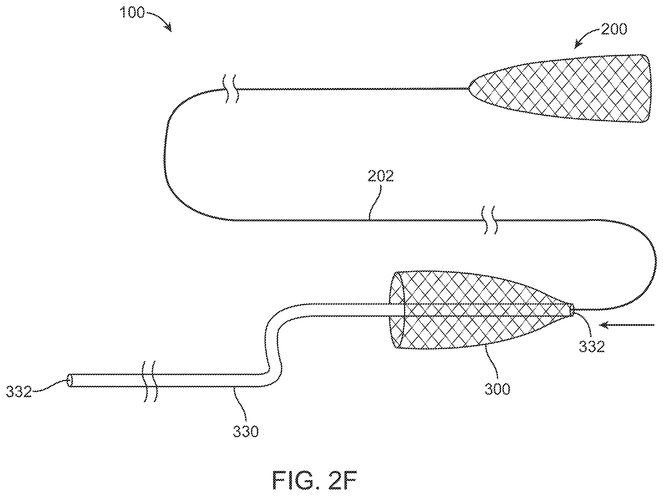 Patent US12396743 Figure 4 – Retrieval systems and methods for use thereof