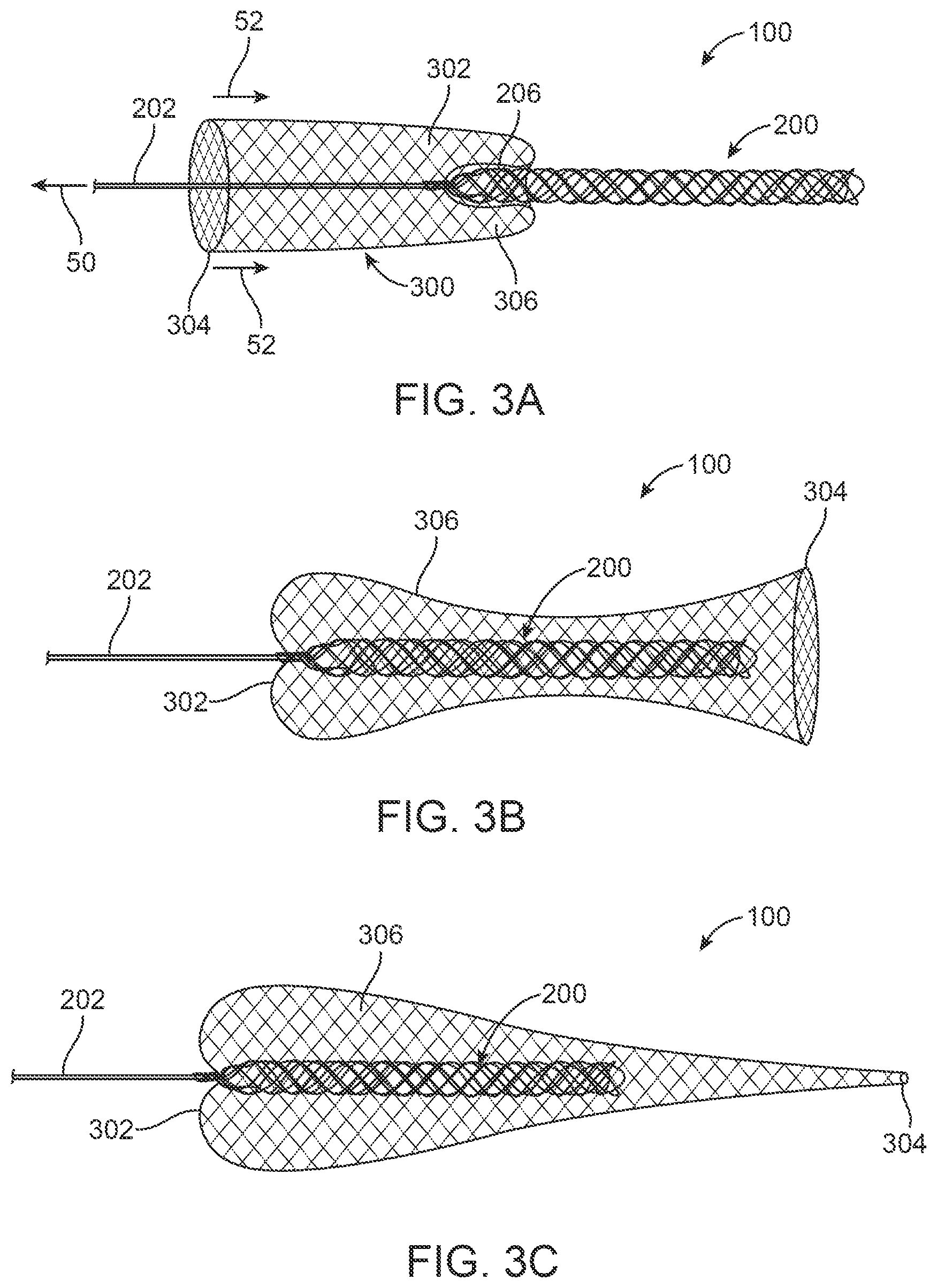 Patent US12396743 Figure 5 – Retrieval systems and methods for use thereof
