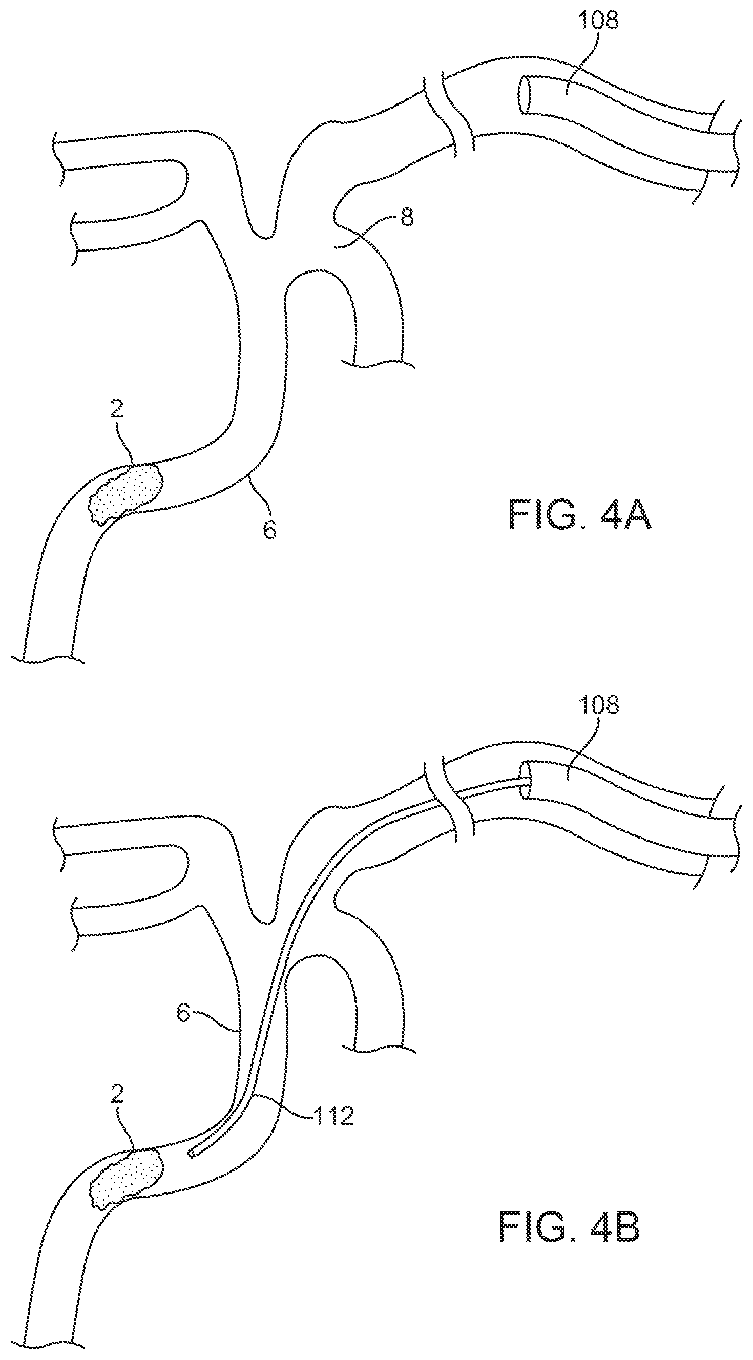 Patent US12396743 Figure 6 – Retrieval systems and methods for use thereof