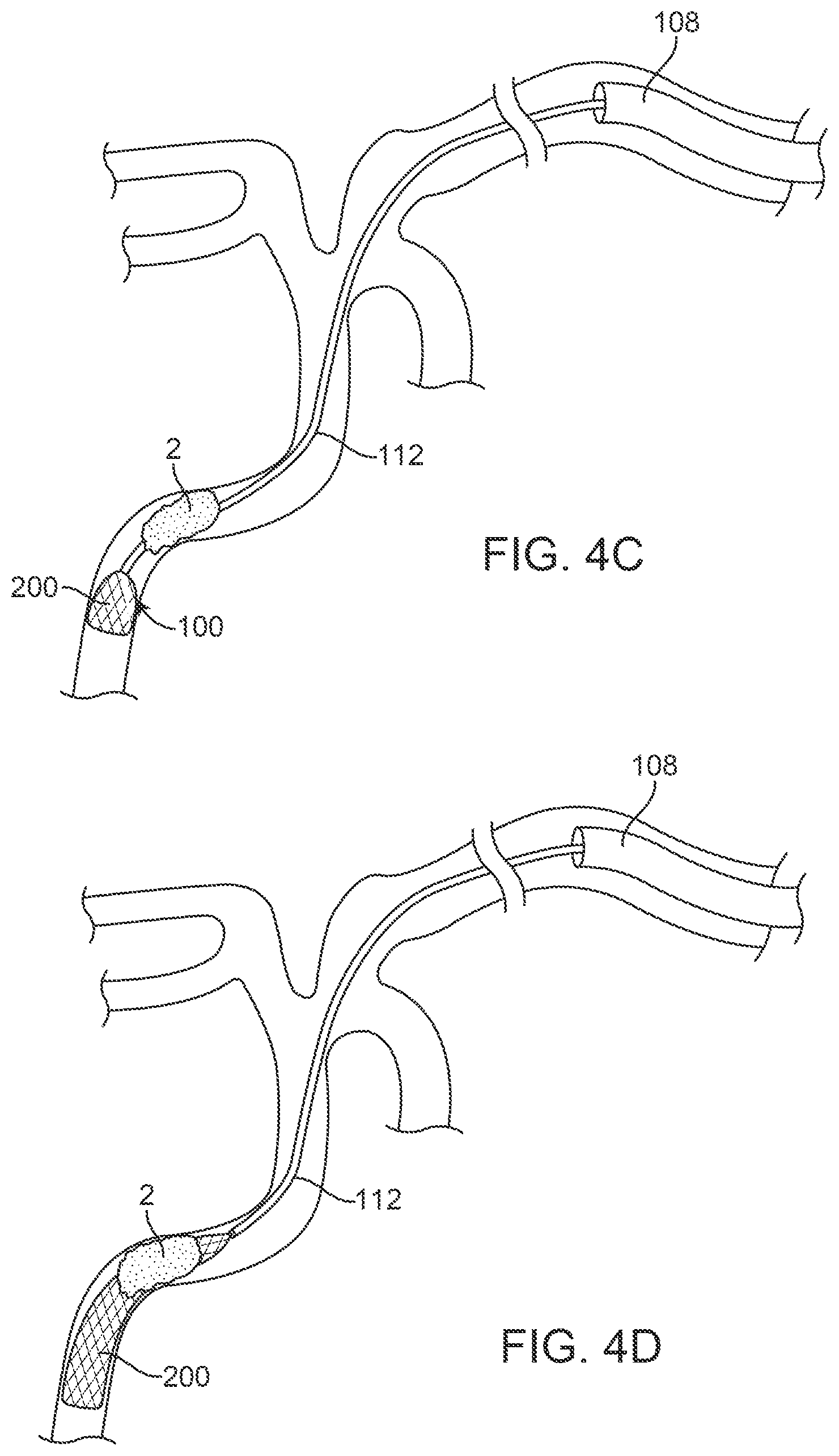Patent US12396743 Figure 7 – Retrieval systems and methods for use thereof