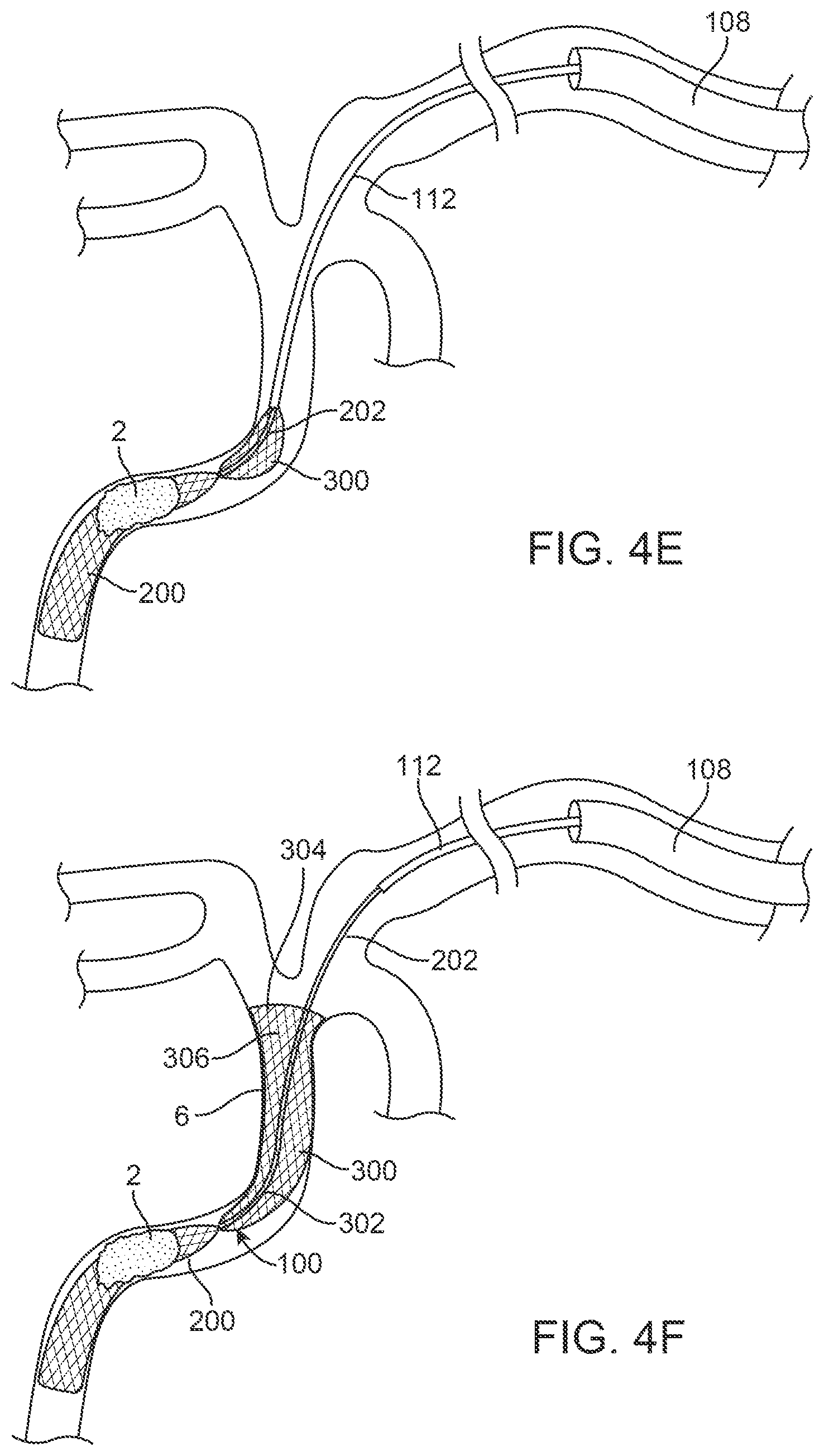 Patent US12396743 Figure 8 – Retrieval systems and methods for use thereof