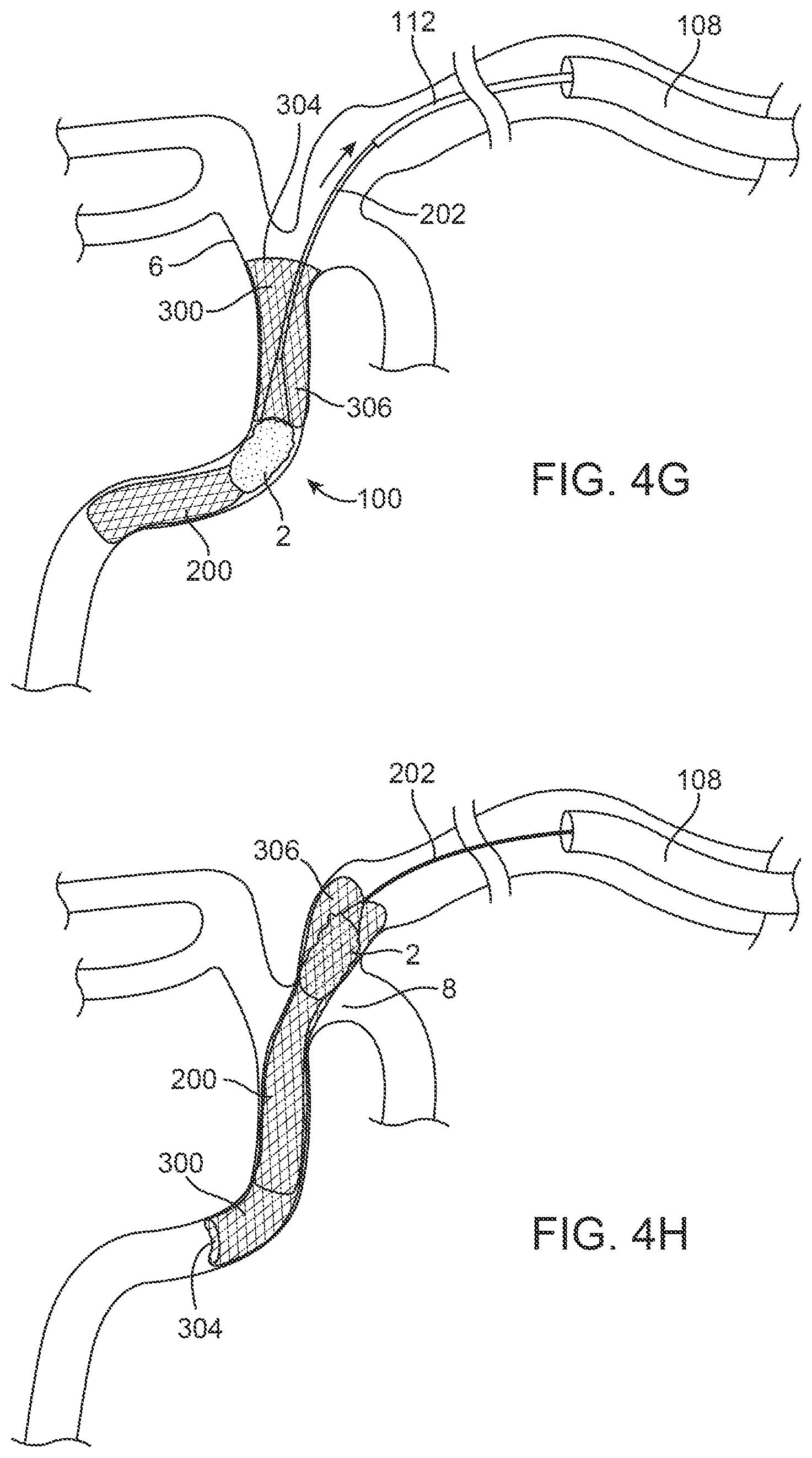 Patent US12396743 Figure 9 – Retrieval systems and methods for use thereof