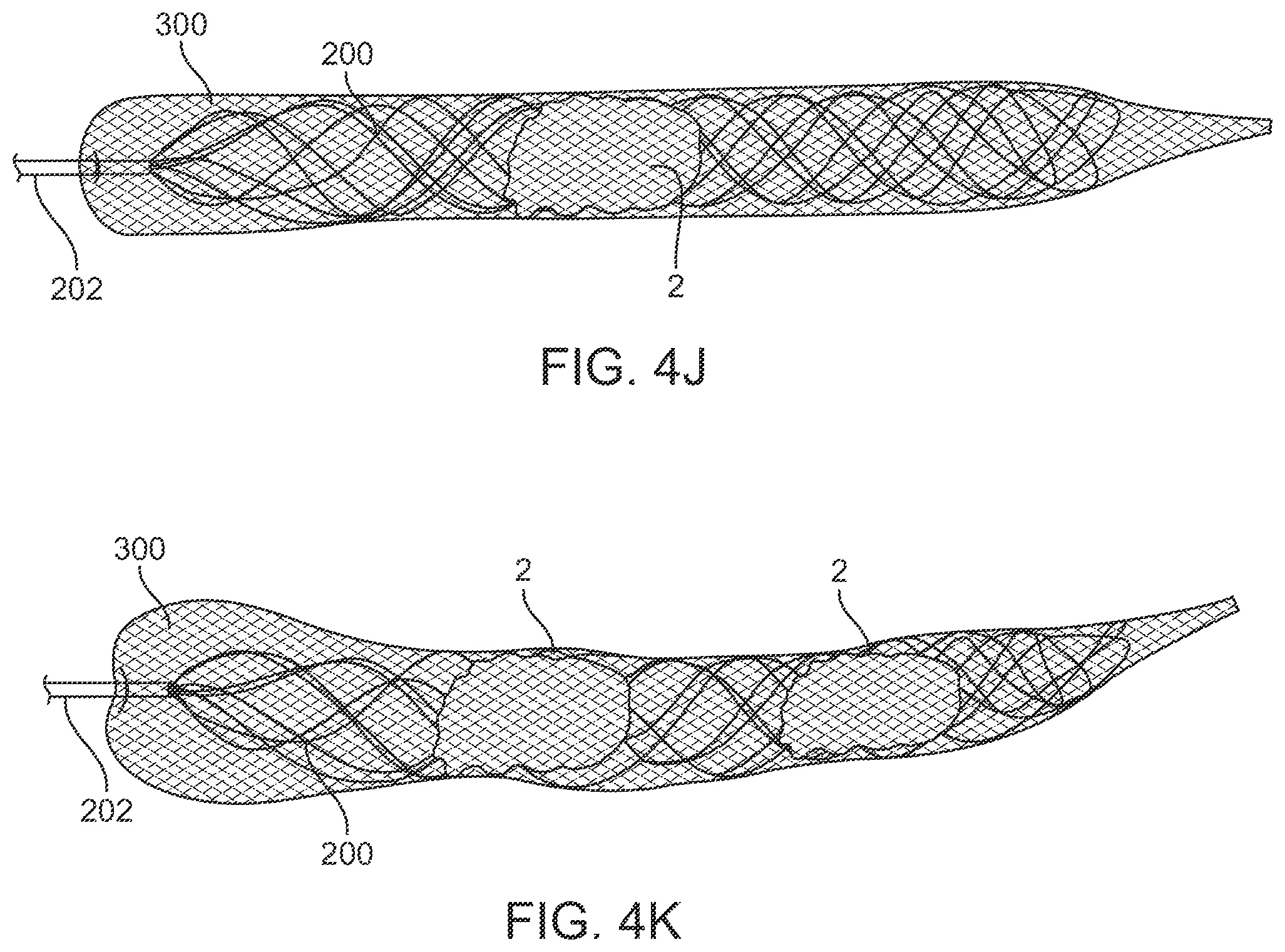 Patent US12396743 Figure 11 – Retrieval systems and methods for use thereof