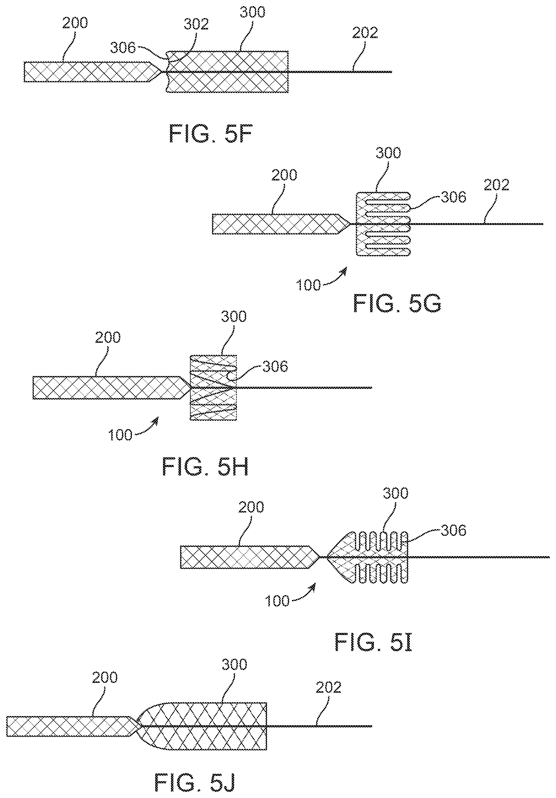 Patent US12396743 Figure 13 – Retrieval systems and methods for use thereof