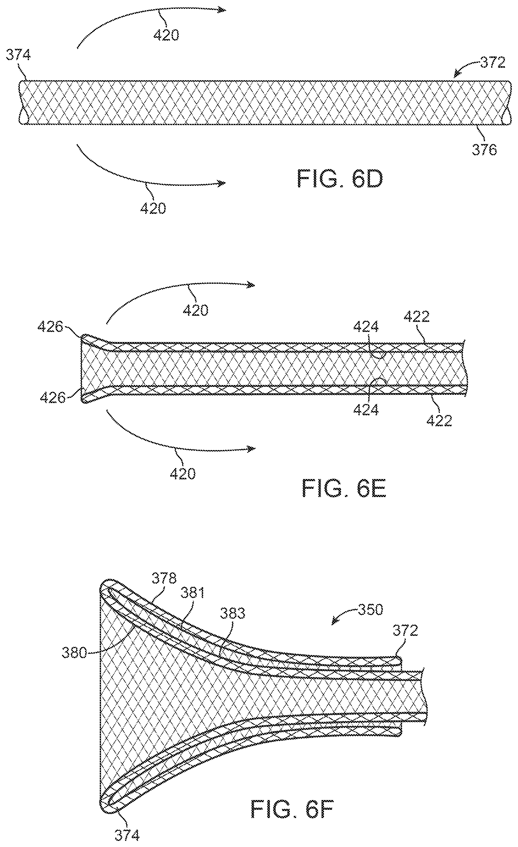 Patent US12396743 Figure 16 – Retrieval systems and methods for use thereof