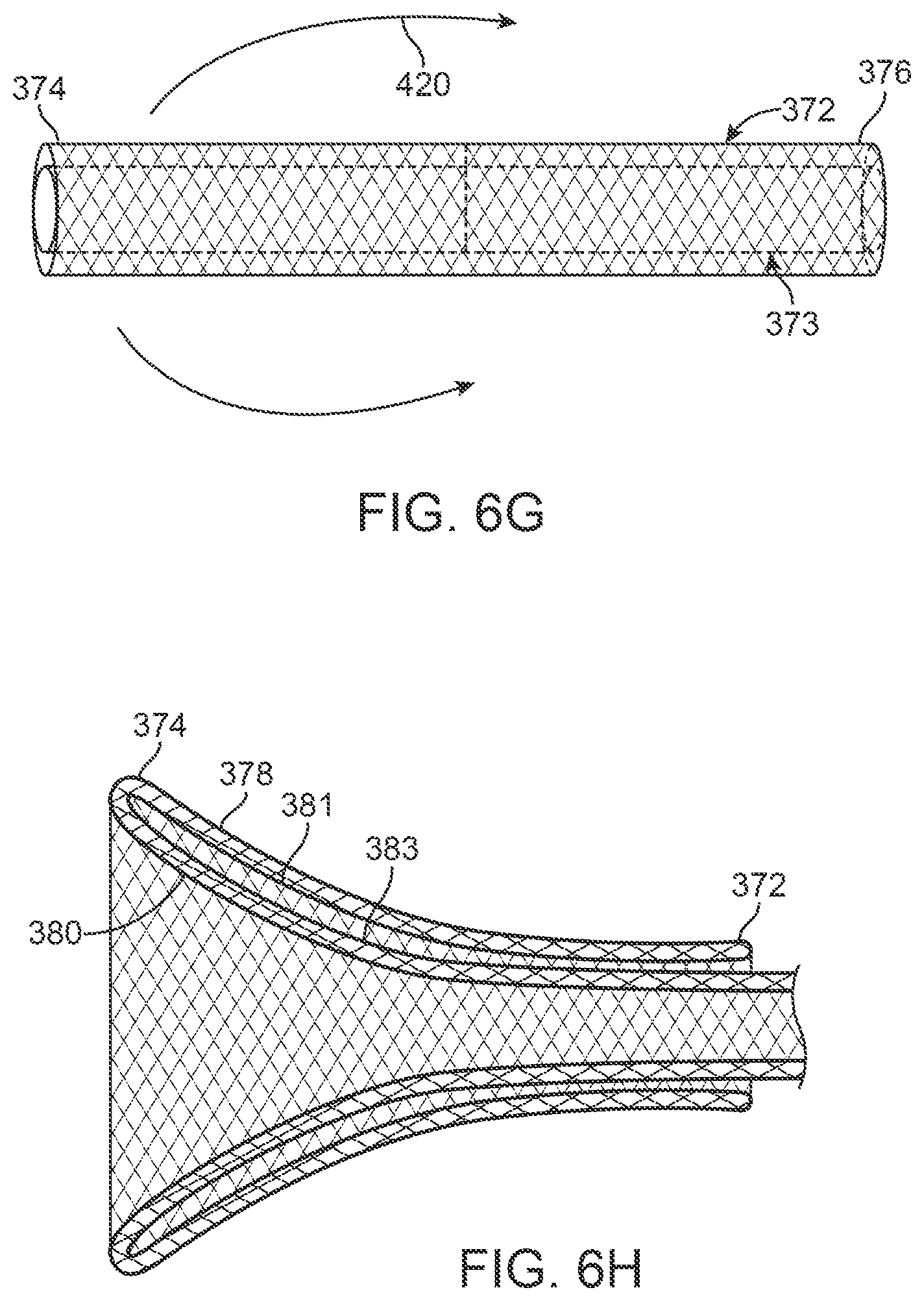 Patent US12396743 Figure 17 – Retrieval systems and methods for use thereof
