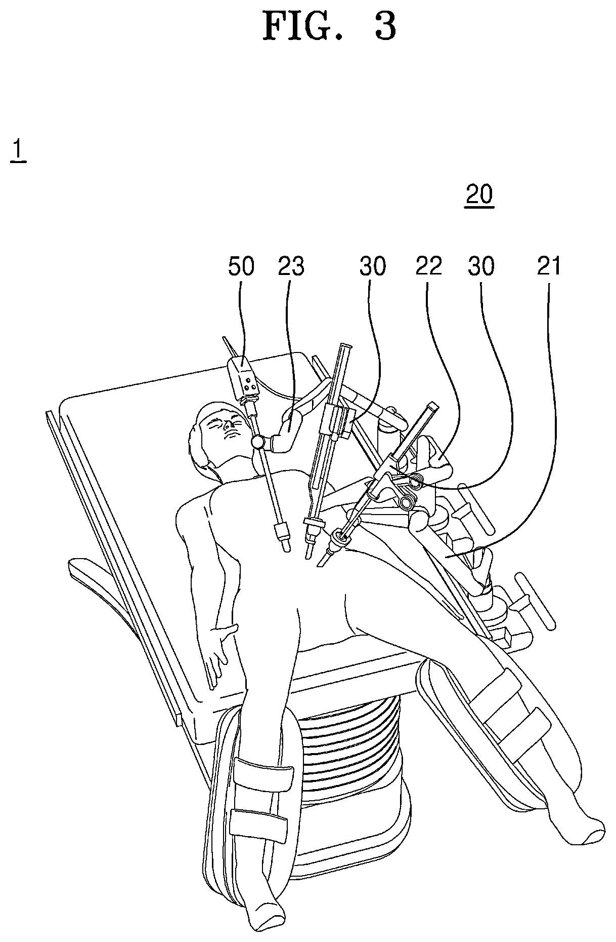 Patent US12396745 Figure 3 – Surgery instrument