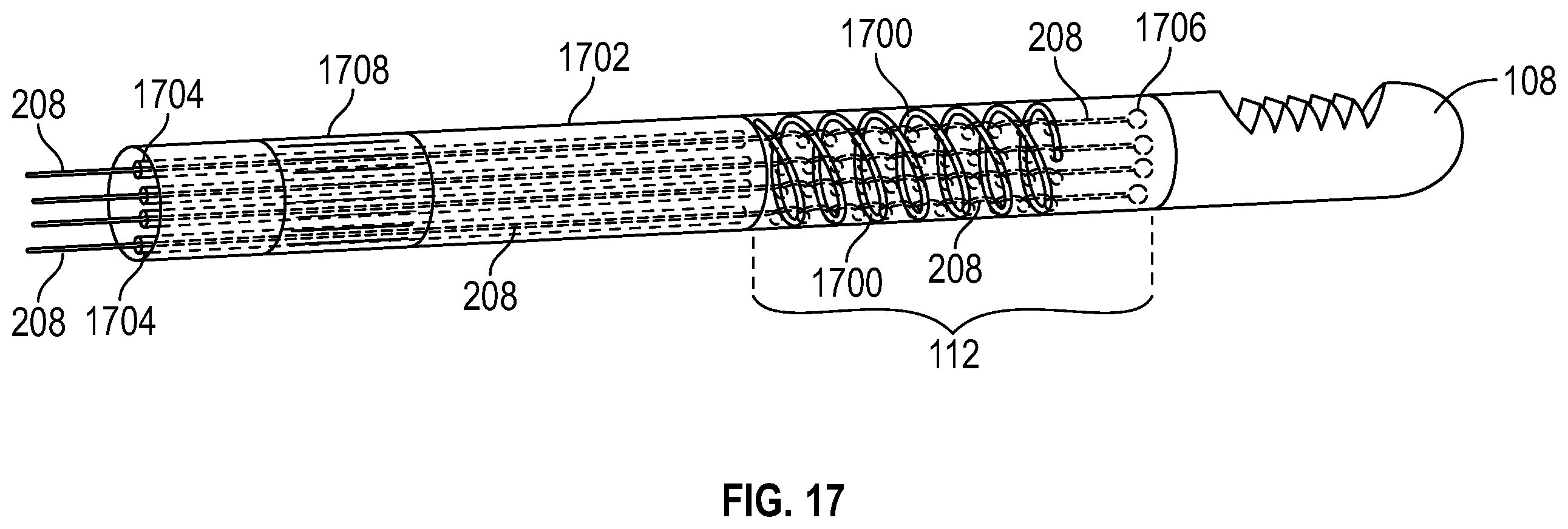 Patent US12396747 Figure 15 – Articulating debrider blade tip and handpiece control