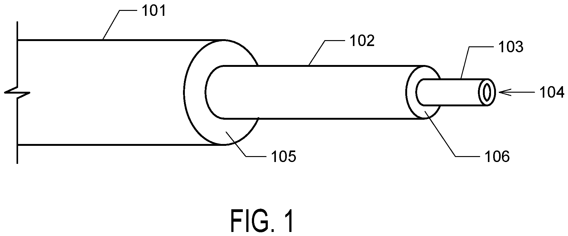 Patent US12396750 — Adjustable stepped cannula — Figure 1