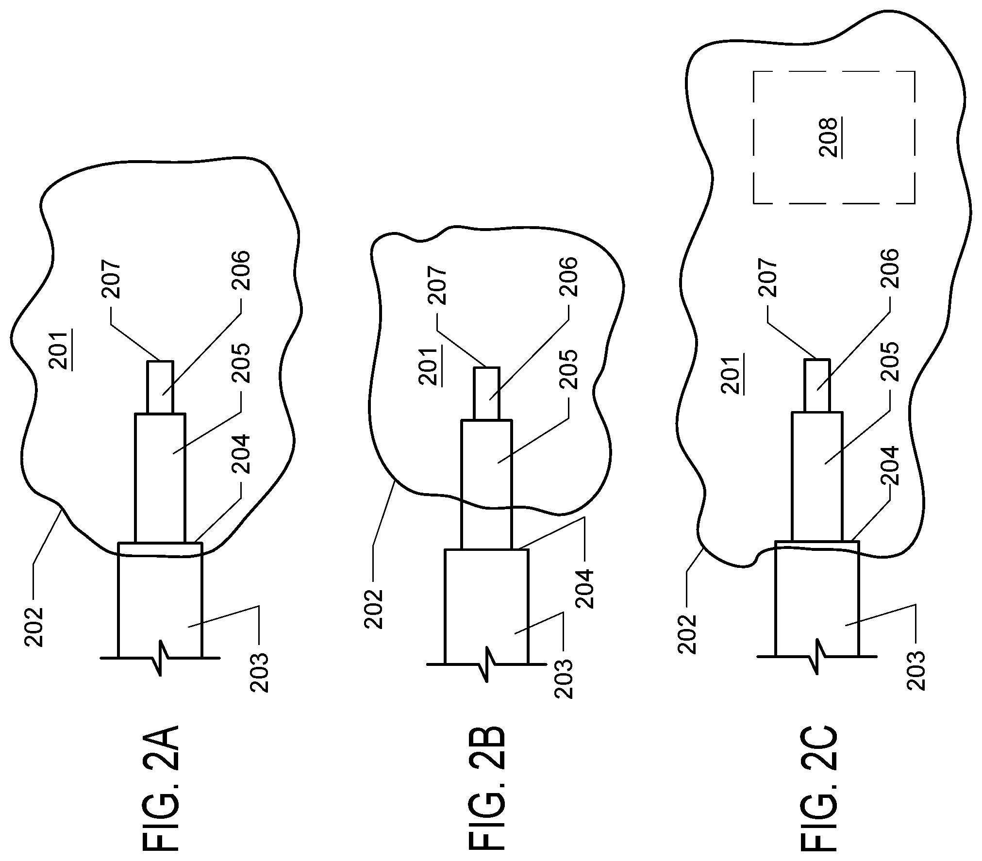 Patent US12396750 Figure 2 – Adjustable stepped cannula