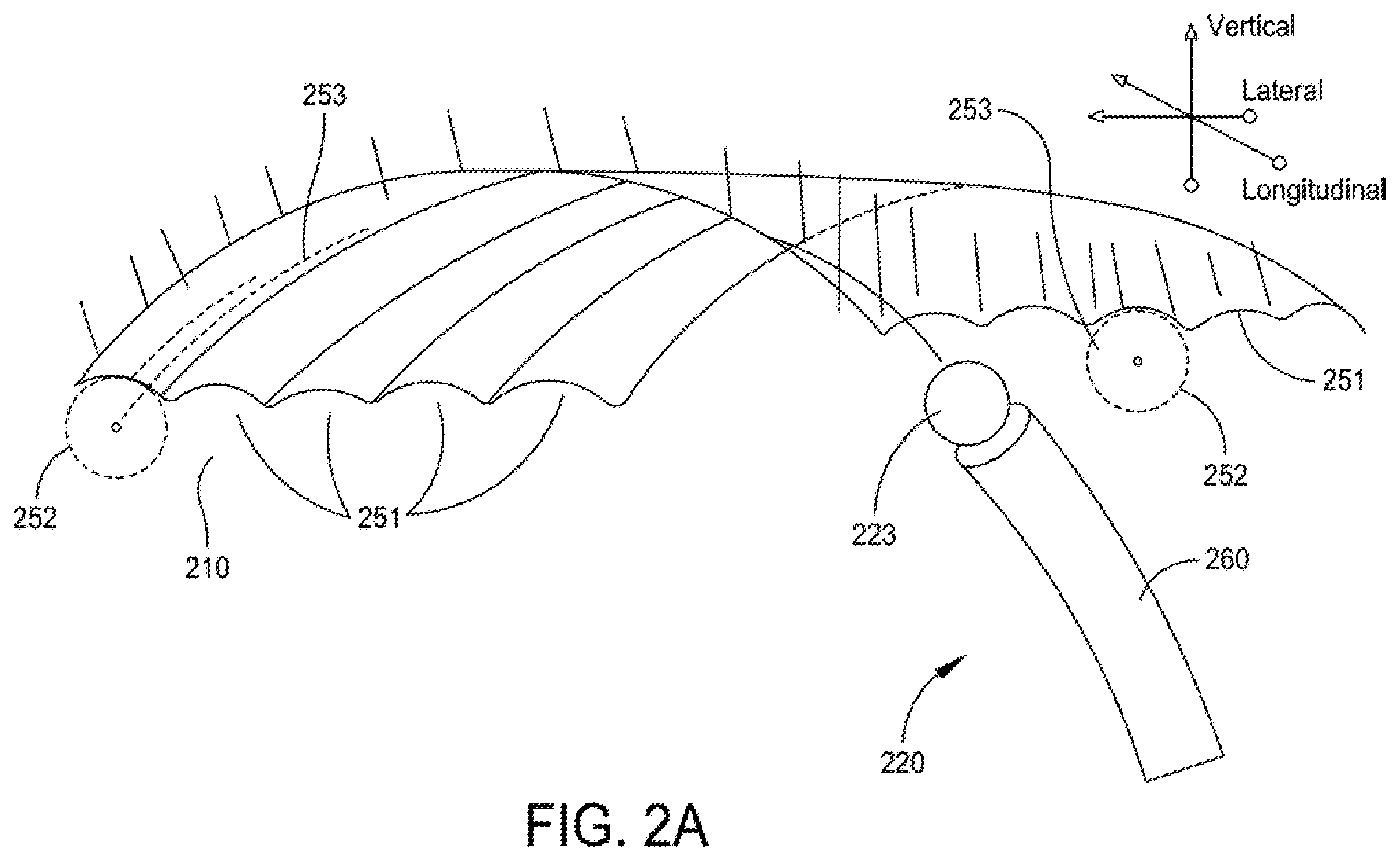 Patent US12396755 Figure 2 – Methods and apparatus for joint repair
