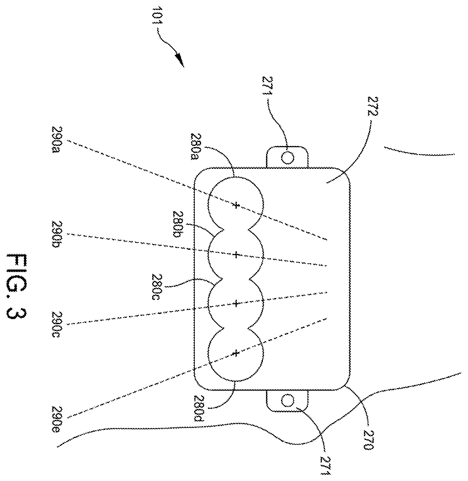 Patent US12396755 Figure 4 – Methods and apparatus for joint repair