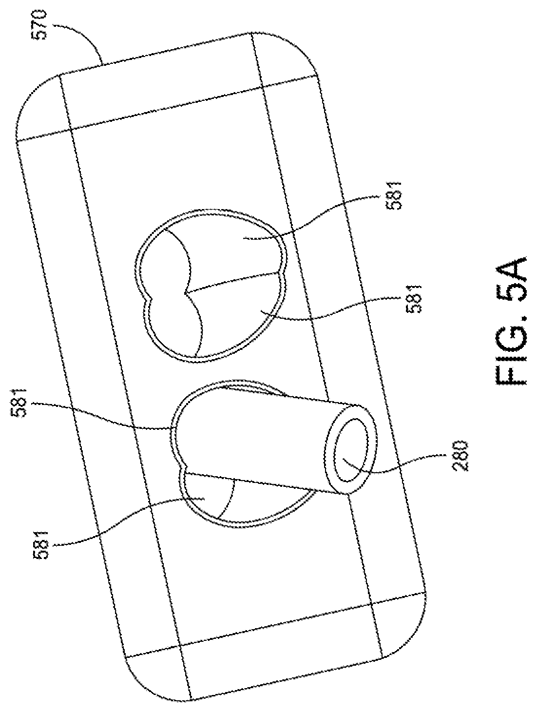 Patent US12396755 Figure 6 – Methods and apparatus for joint repair