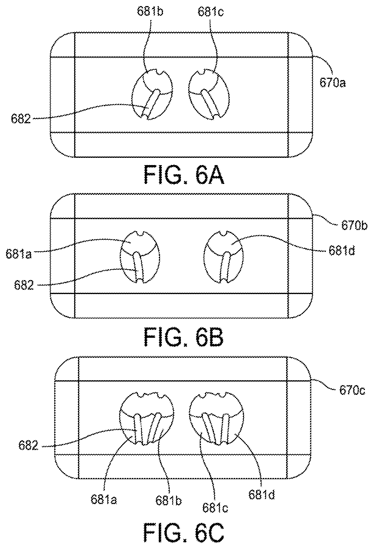 Patent US12396755 Figure 8 – Methods and apparatus for joint repair