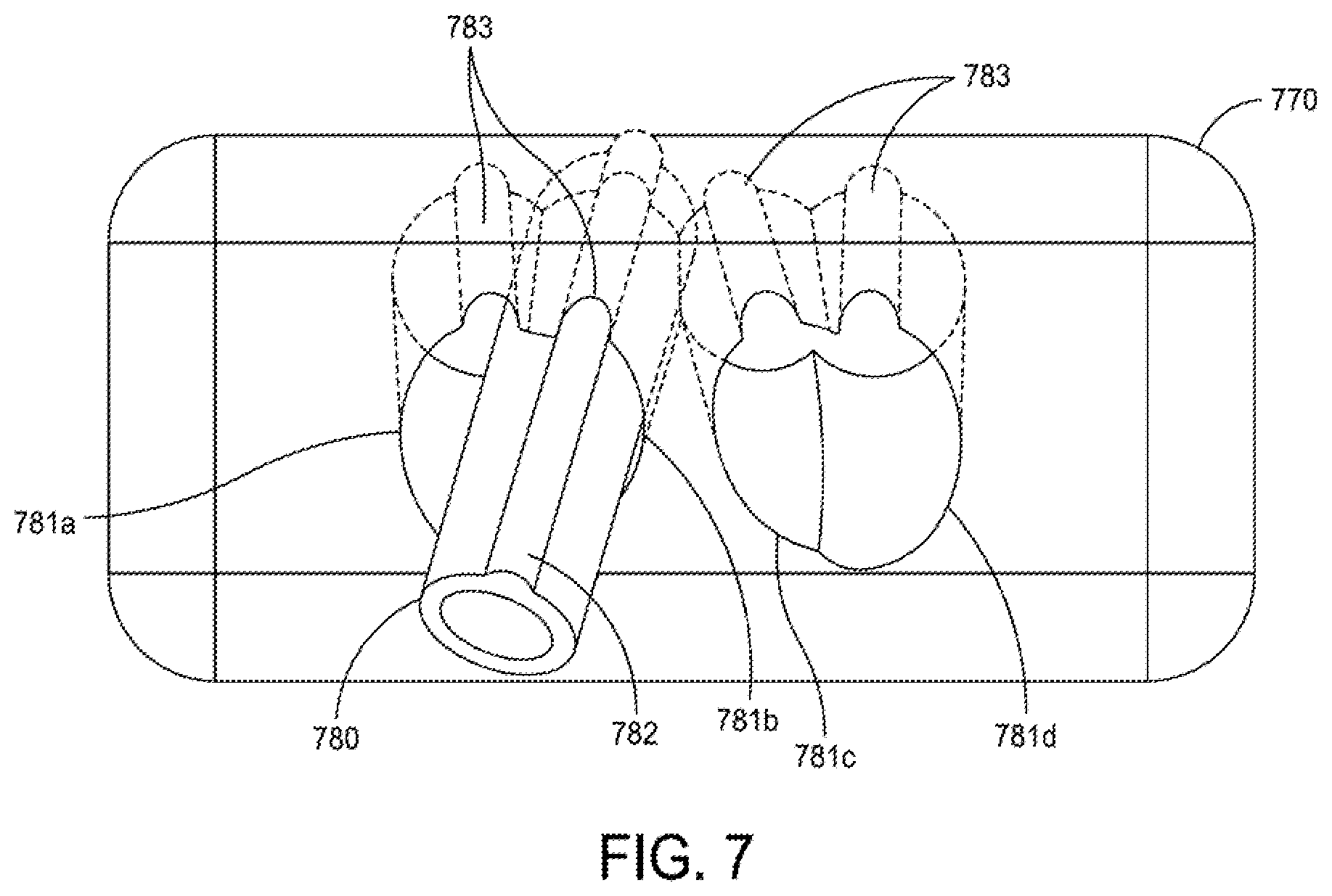 Patent US12396755 Figure 9 – Methods and apparatus for joint repair
