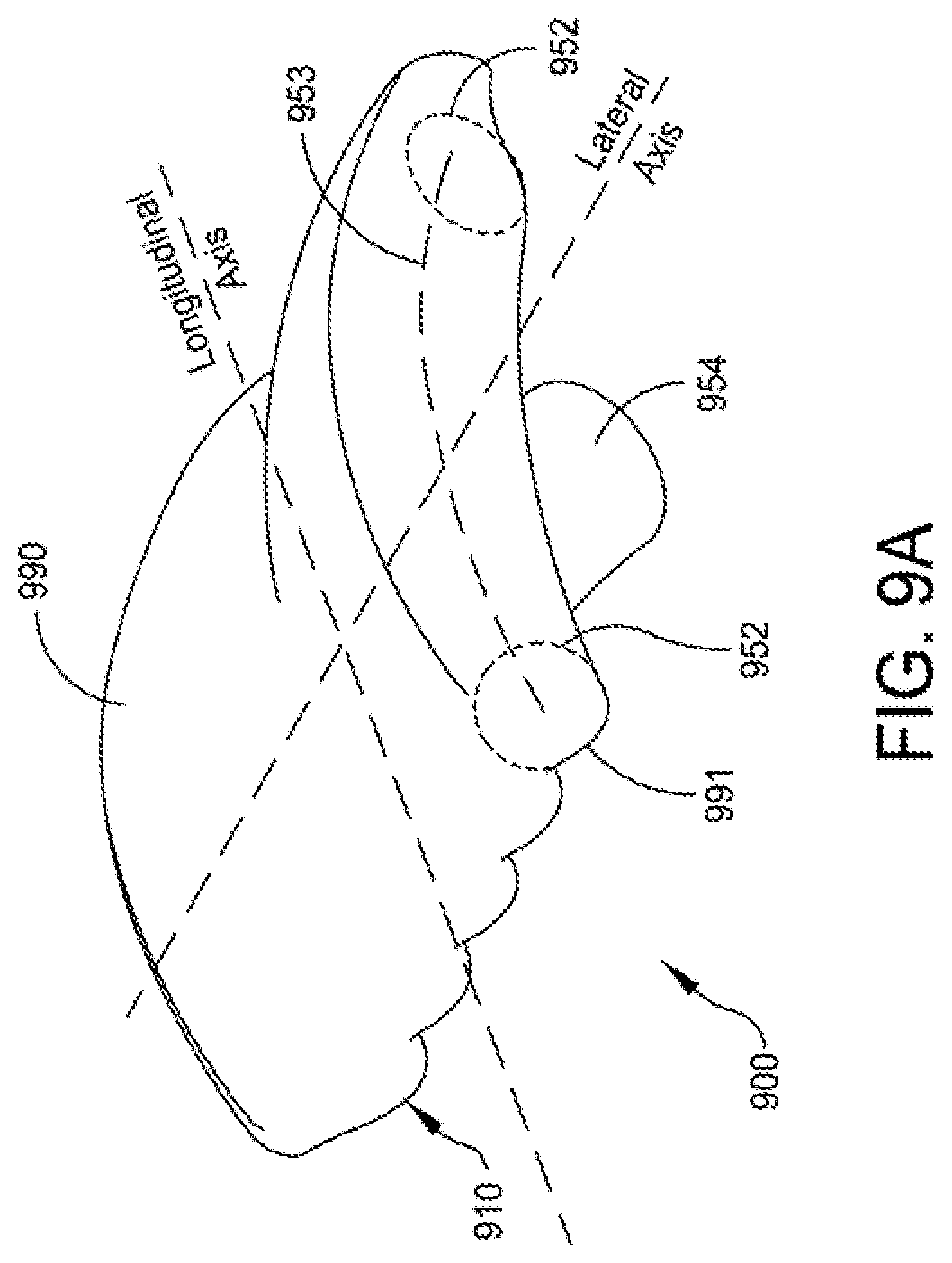 Patent US12396755 Figure 11 – Methods and apparatus for joint repair