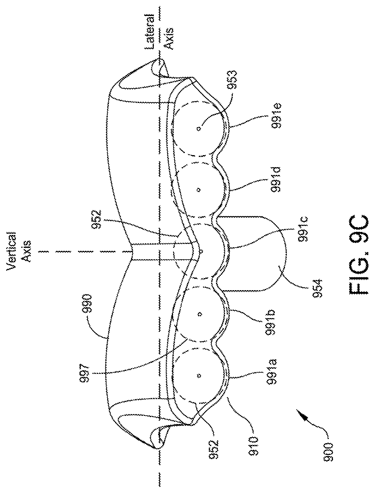 Patent US12396755 Figure 13 – Methods and apparatus for joint repair