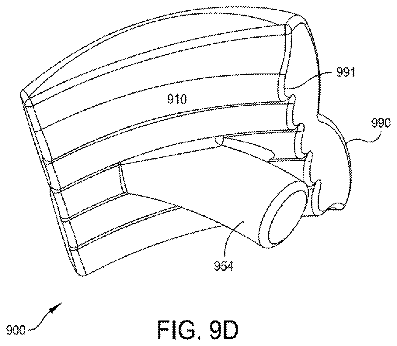Patent US12396755 Figure 14 – Methods and apparatus for joint repair