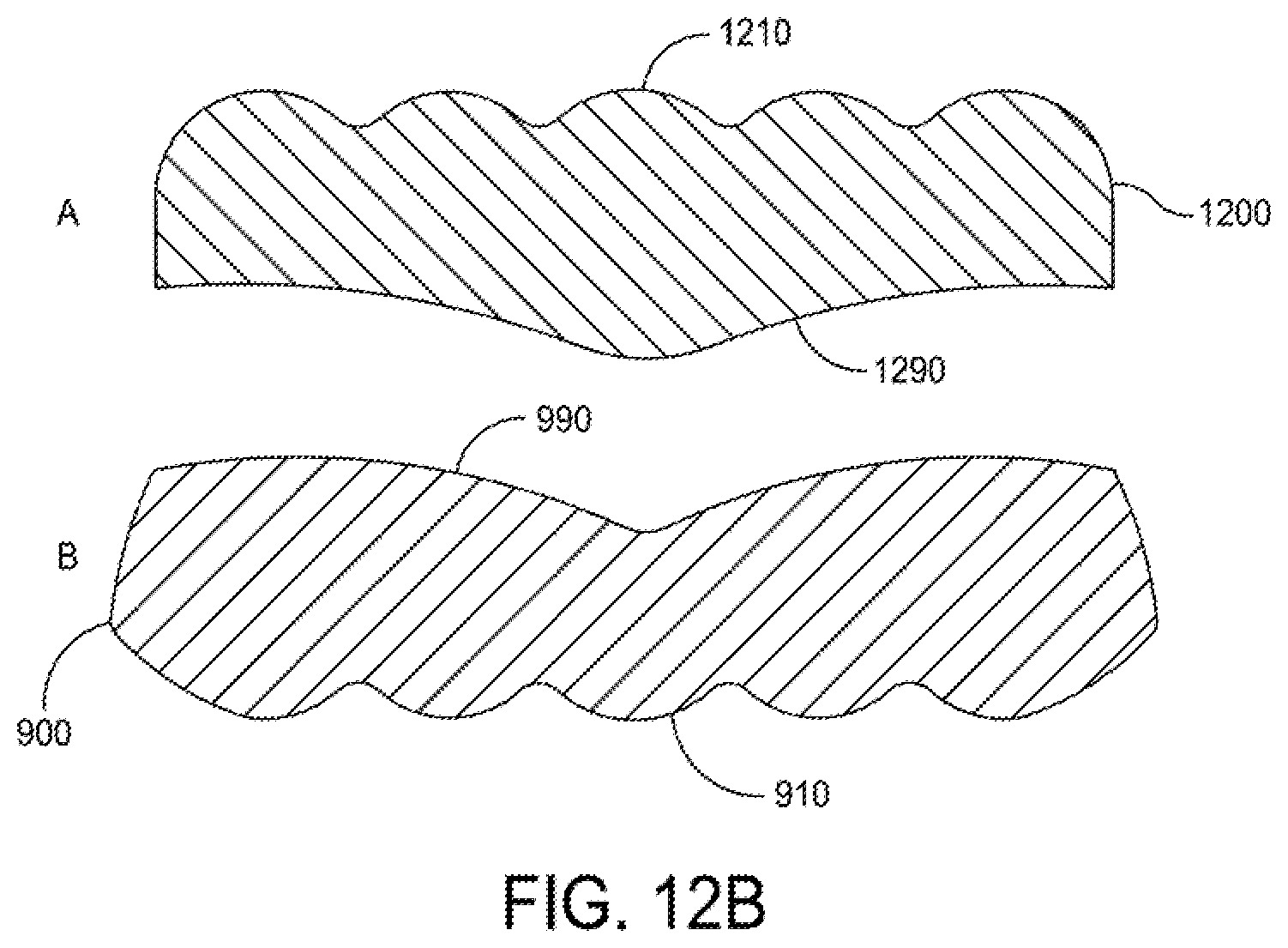 Patent US12396755 Figure 18 – Methods and apparatus for joint repair