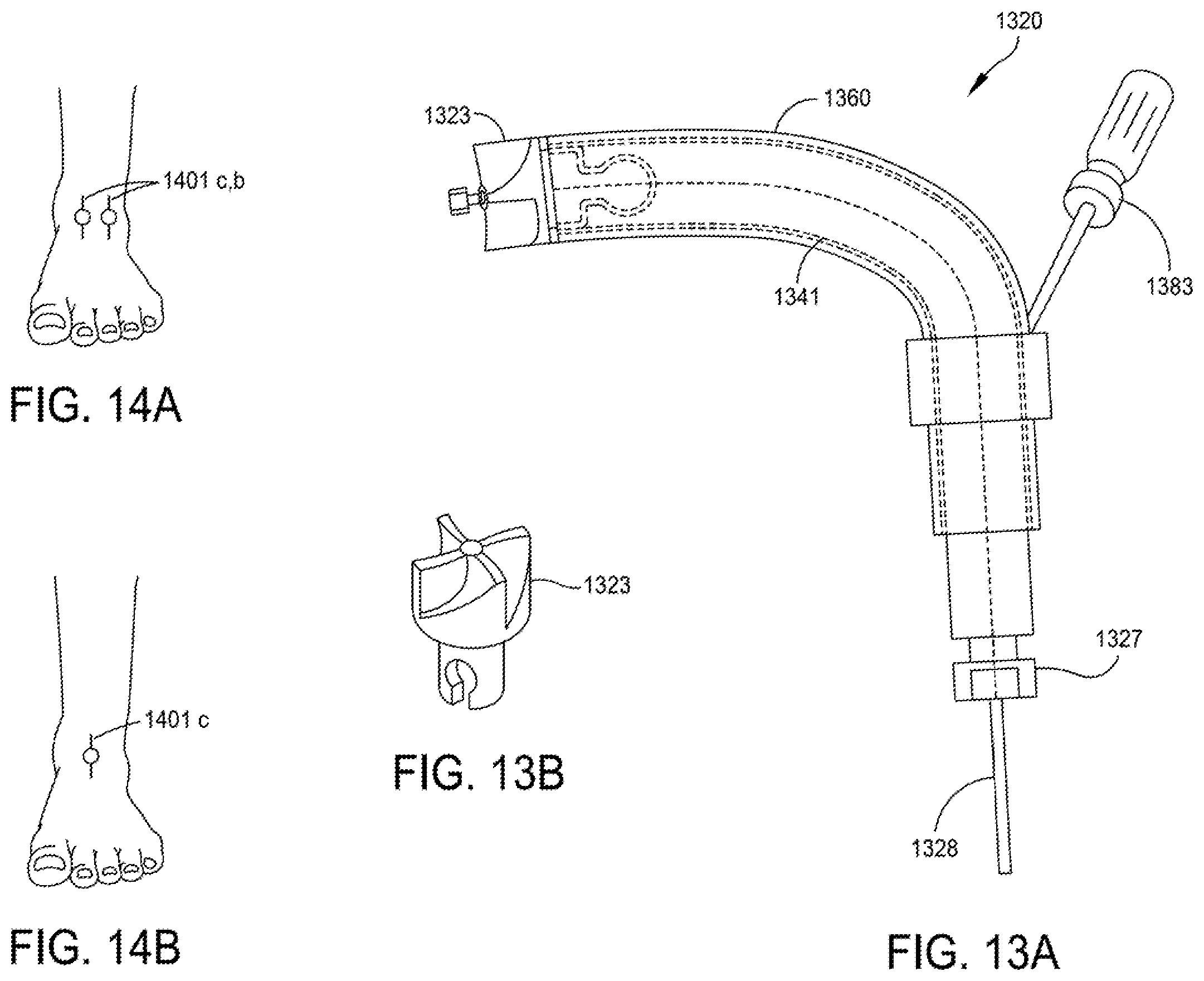 Patent US12396755 Figure 19 – Methods and apparatus for joint repair