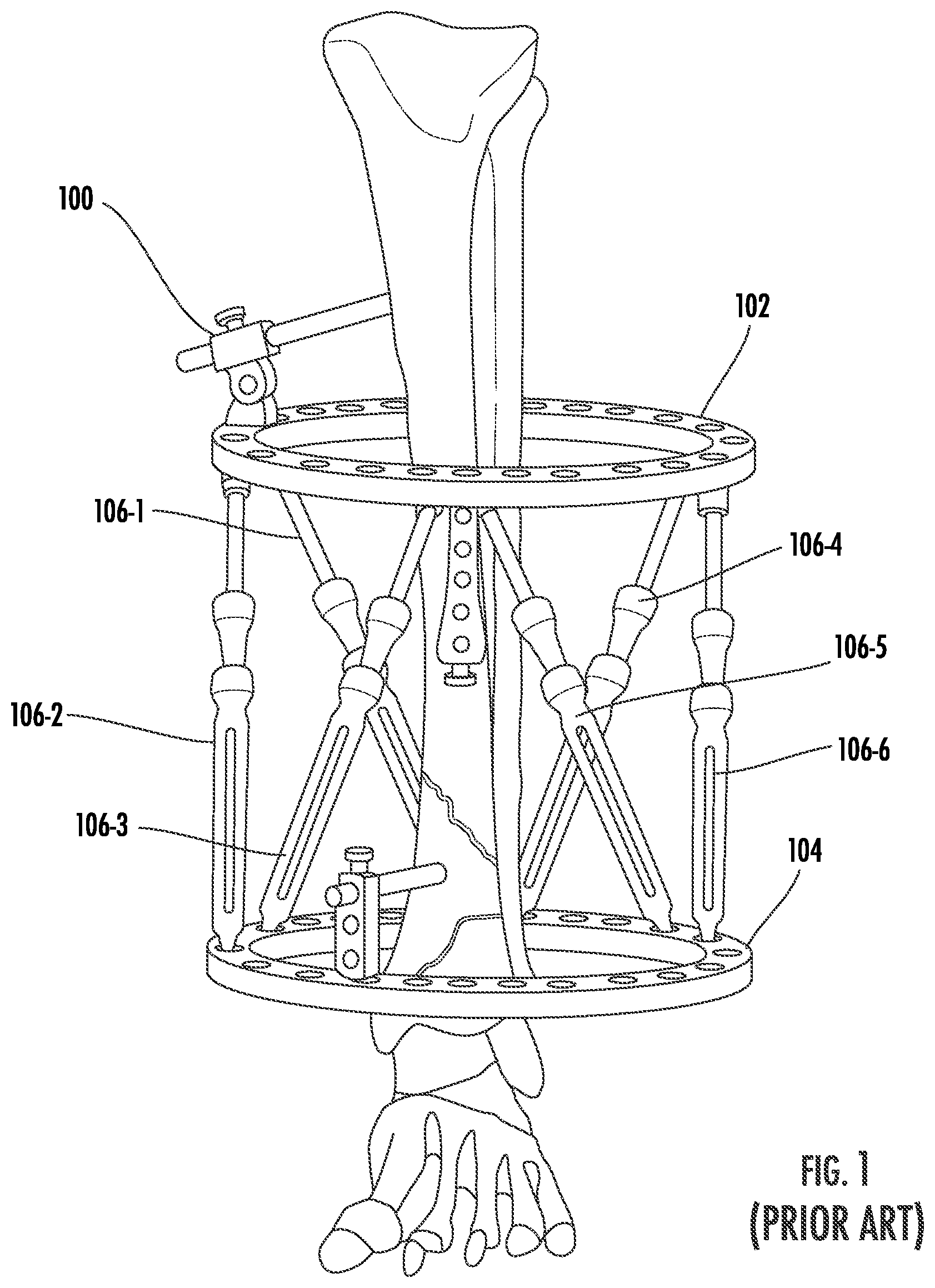 Patent US12396756 Figure 1 – Conversion kit for an external fixation system