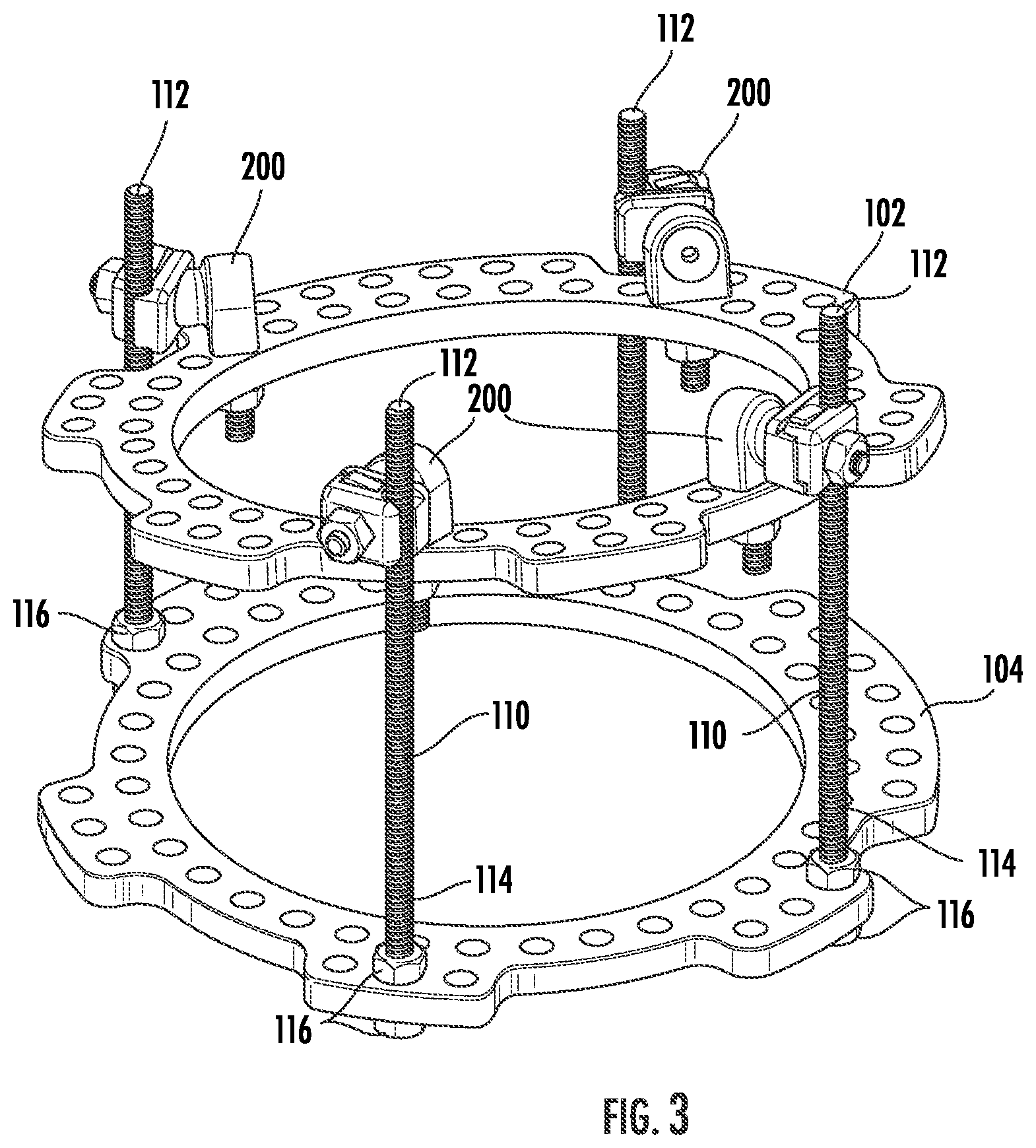 Patent US12396756 Figure 3 – Conversion kit for an external fixation system